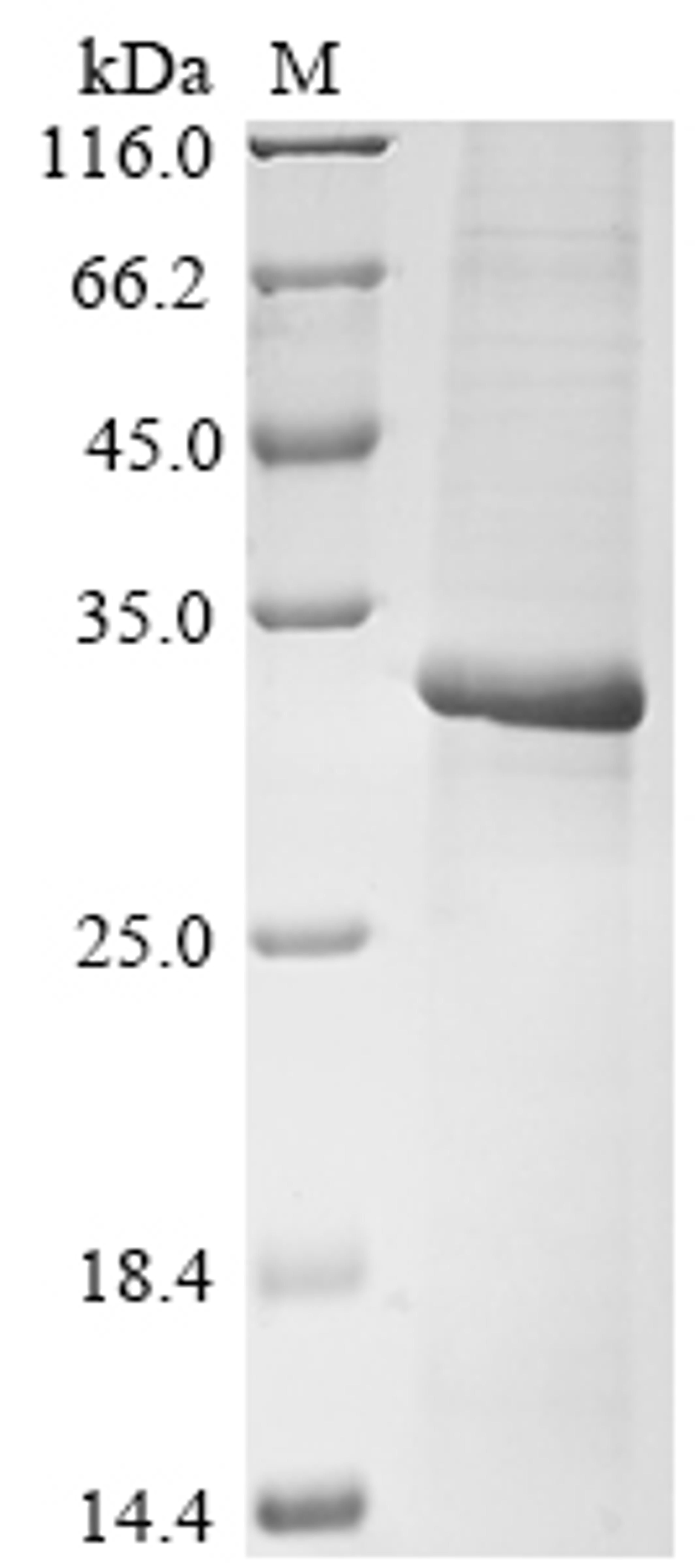 (Tris-Glycine gel) Discontinuous SDS-PAGE (reduced) with 5% enrichment gel and 15% separation gel.