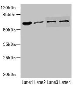 Western blot. All lanes: NOX3antibody at 0.96ug/ml. Lane 1: Mouse kidney tissue. Lane 2: 293T whole cell lysate. Lane 3: HepG2 whole cell lysate. Lane 4: Hela whole cell lysate. Secondary. Goat polyclonal to rabbit IgG at 1/10000 dilution. Predicted band size: 65 kDa. Observed band size: 65 kDa. 