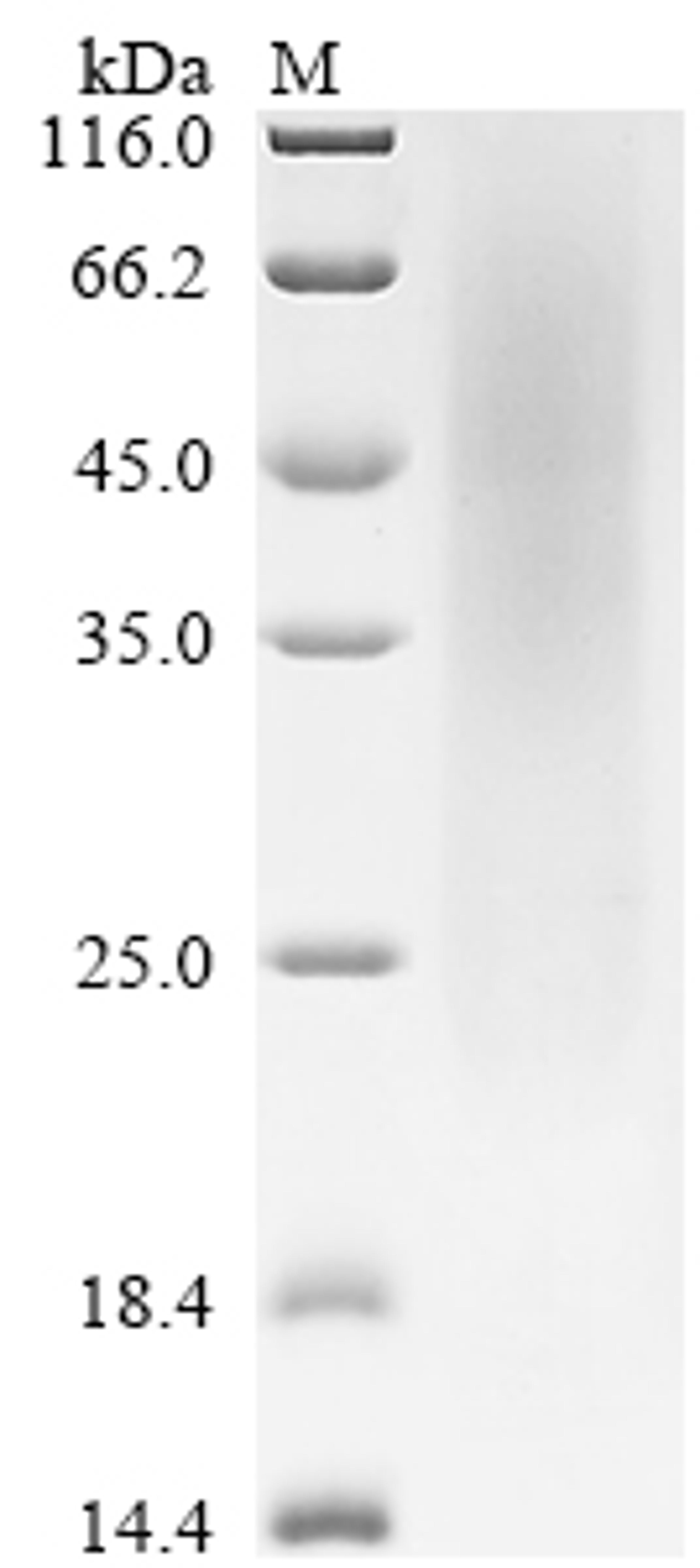 (Tris-Glycine gel) Discontinuous SDS-PAGE (reduced) with 5% enrichment gel and 15% separation gel.