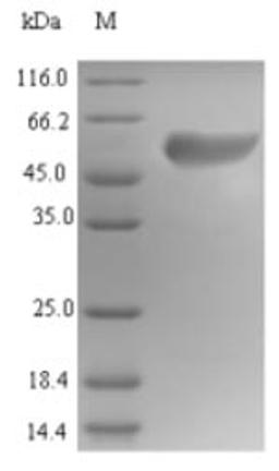 (Tris-Glycine gel) Discontinuous SDS-PAGE (reduced) with 5% enrichment gel and 15% separation gel.