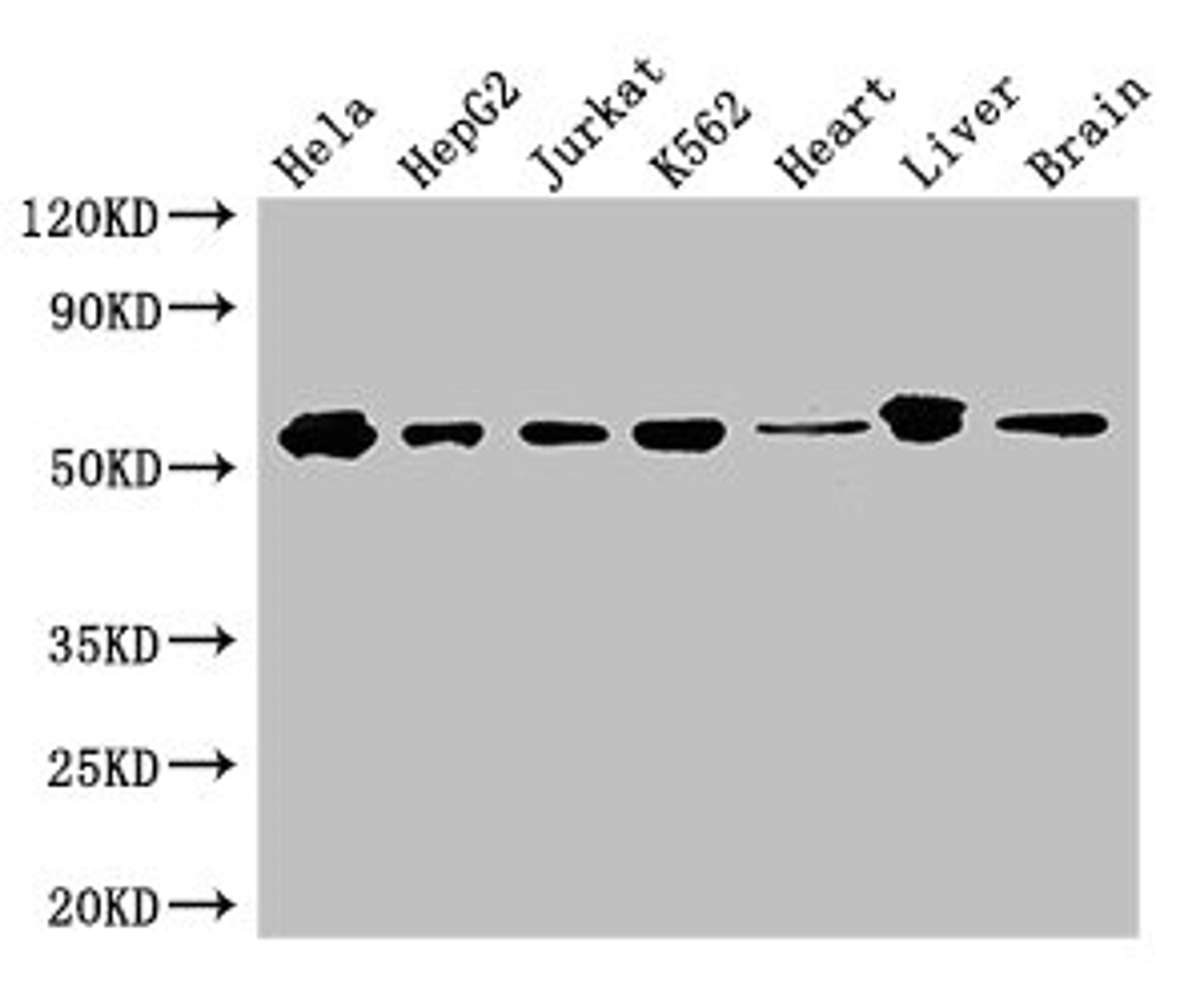 Western Blot. Positive WB detected in: Hela whole cell lysate, HepG2 whole cell lysate, Jurkat whole cell lysate, K562 whole cell lysate, Mouse heart tissue, Mouse liver tissue, Mouse brain tissue. All lanes: SMAD2 antibody at 3ug/ml. Secondary. Goat polyclonal to rabbit IgG at 1/50000 dilution. Predicted band size: 53, 49 kDa. Observed band size: 53 kDa. 