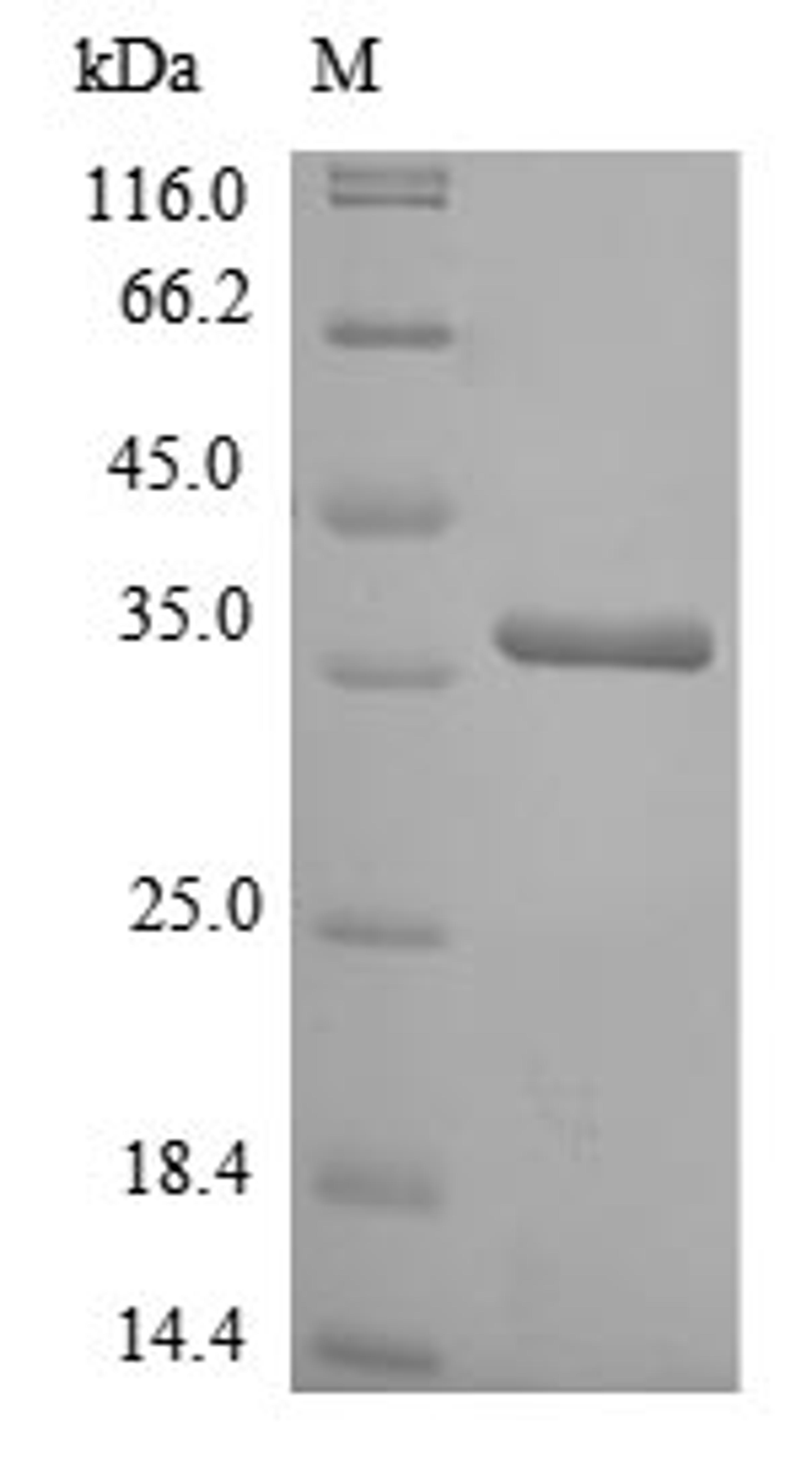 (Tris-Glycine gel) Discontinuous SDS-PAGE (reduced) with 5% enrichment gel and 15% separation gel.