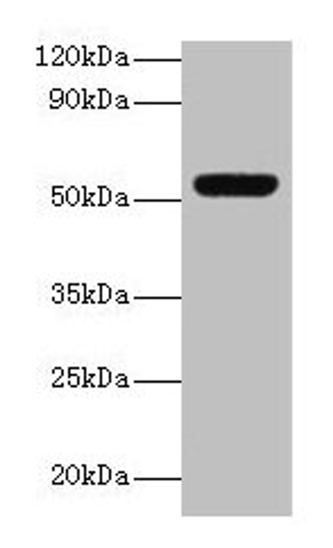 Western blot. All lanes: MMP3 antibody at 2µg/ml + Mouse liver tissue. Secondary. Goat polyclonal to rabbit lgG at 1/15000 dilution. Predicted band size: 54 kDa. Observed band size: 54 kDa