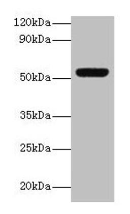 Western blot. All lanes: MMP3 antibody at 2µg/ml + Mouse liver tissue. Secondary. Goat polyclonal to rabbit lgG at 1/15000 dilution. Predicted band size: 54 kDa. Observed band size: 54 kDa