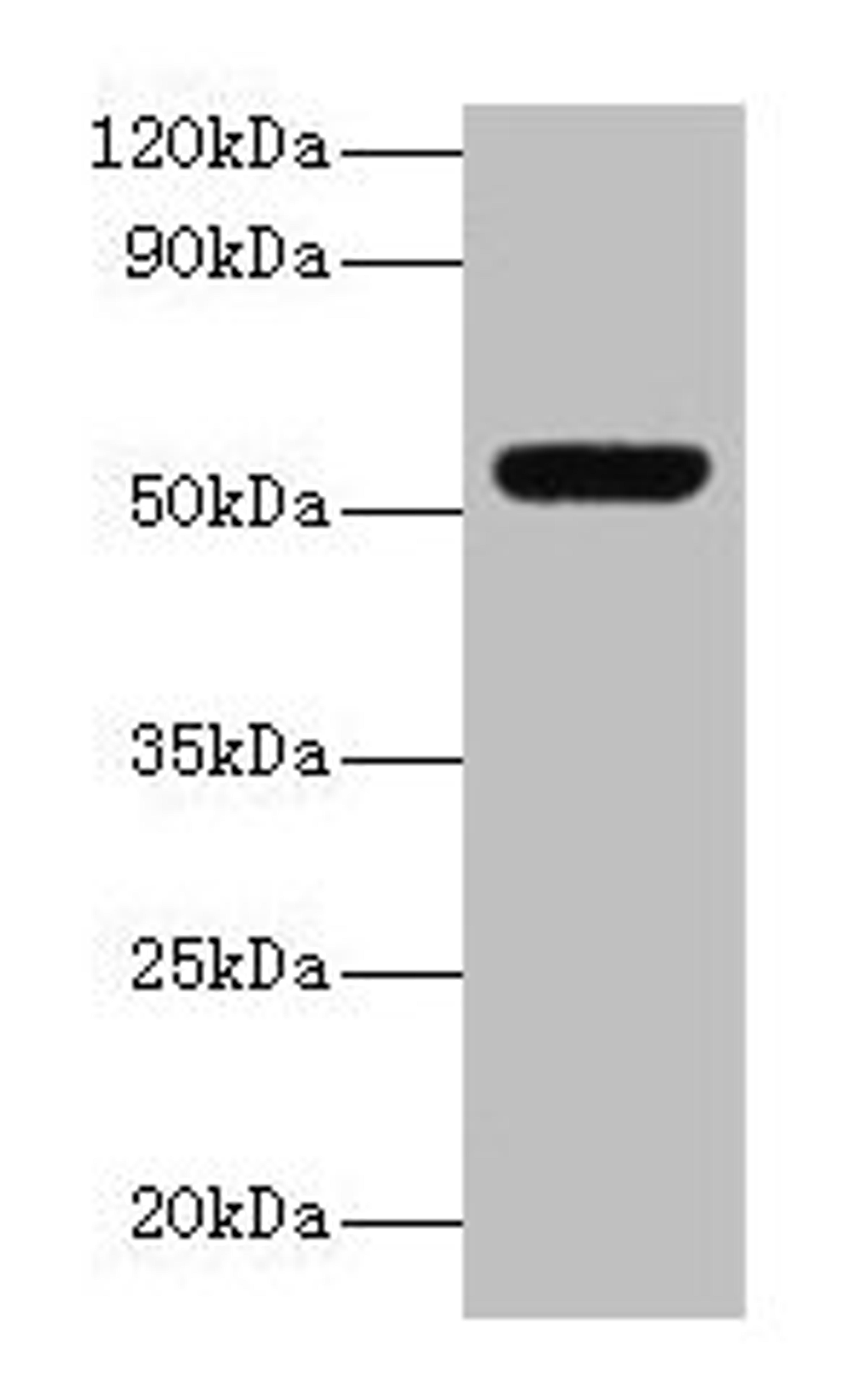 Western blot. All lanes: MMP3 antibody at 2µg/ml + Mouse liver tissue. Secondary. Goat polyclonal to rabbit lgG at 1/15000 dilution. Predicted band size: 54 kDa. Observed band size: 54 kDa