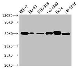Western Blot. Positive WB detected in: MCF-7 whole cell lysate, HL60 whole cell lysate, NIH/3T3 whole cell lysate, Colo320 whole cell lysate, Hela whole cell lysate, SH-SY5Y whole cell lysate. All lanes: CALR antibody at 2ug/ml. Secondary. Goat polyclonal to rabbit IgG at 1/10000 dilution. Predicted band size: 49 kDa. Observed band size: 49 kDa. 