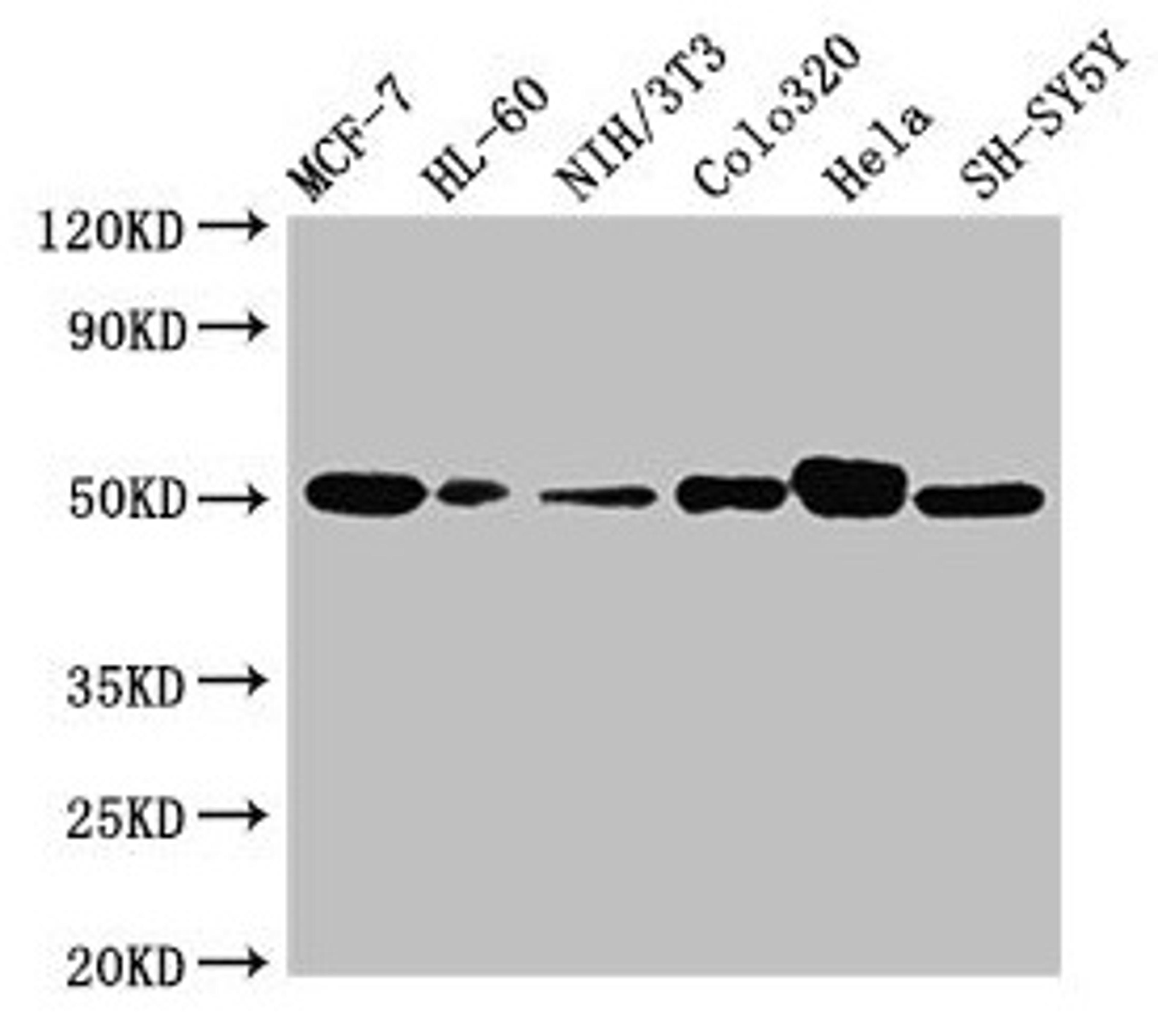 Western Blot. Positive WB detected in: MCF-7 whole cell lysate, HL60 whole cell lysate, NIH/3T3 whole cell lysate, Colo320 whole cell lysate, Hela whole cell lysate, SH-SY5Y whole cell lysate. All lanes: CALR antibody at 2ug/ml. Secondary. Goat polyclonal to rabbit IgG at 1/10000 dilution. Predicted band size: 49 kDa. Observed band size: 49 kDa. 