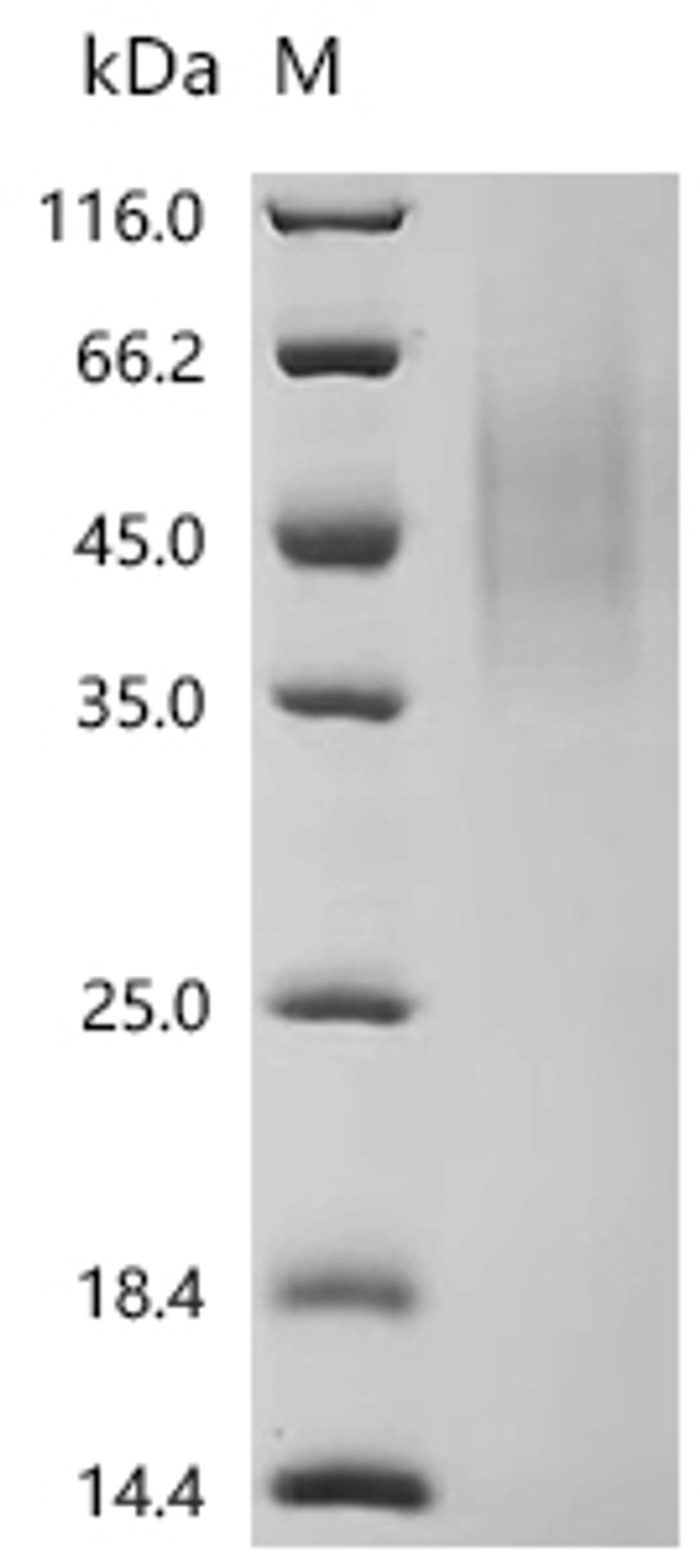 (Tris-Glycine gel) Discontinuous SDS-PAGE (reduced) with 5% enrichment gel and 15% separation gel.
