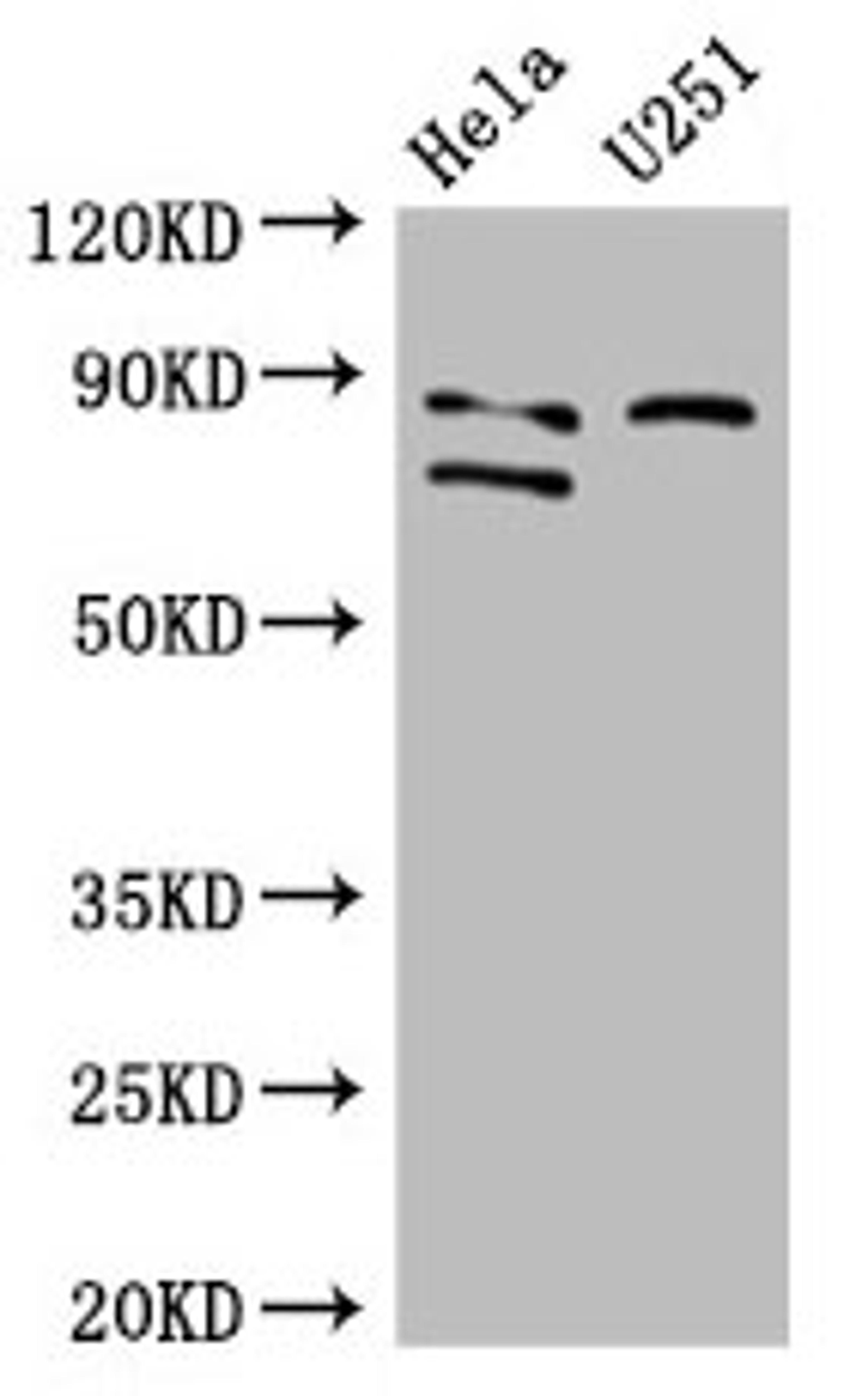 Western Blot. Positive WB detected in: Hela whole cell lysate, U251 whole cell lysate. All lanes: FCHO2 antibody at 3µg/ml. Secondary. Goat polyclonal to rabbit IgG at 1/50000 dilution. Predicted band size: 89, 44, 86 kDa. Observed band size: 89, 86 kDa