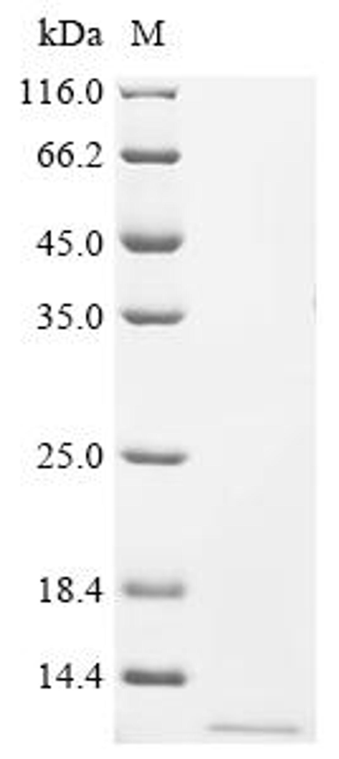(Tris-Glycine gel) Discontinuous SDS-PAGE (reduced) with 5% enrichment gel and 15% separation gel.