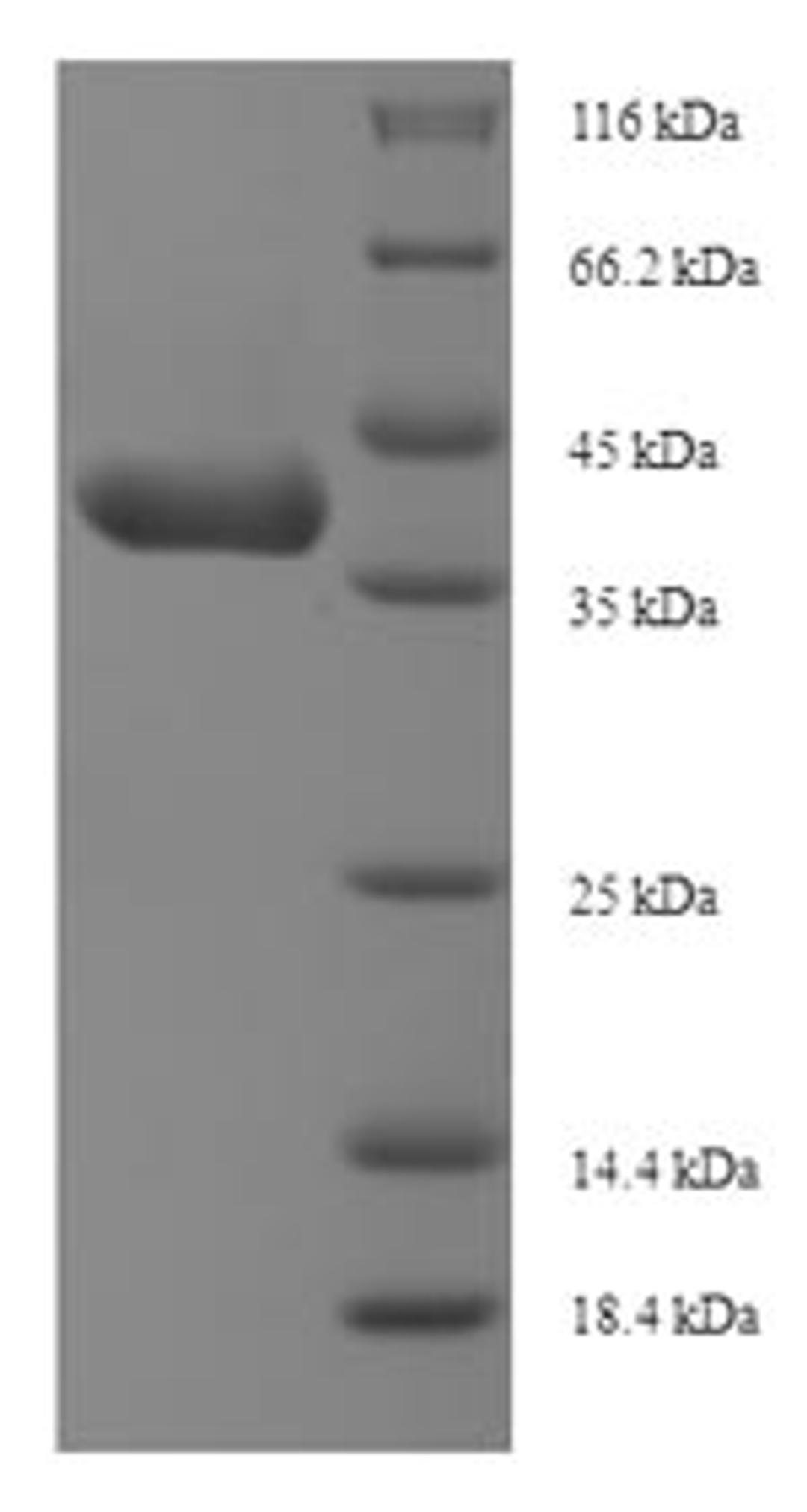 (Tris-Glycine gel) Discontinuous SDS-PAGE (reduced) with 5% enrichment gel and 15% separation gel.