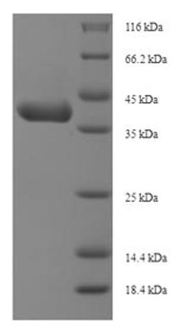 (Tris-Glycine gel) Discontinuous SDS-PAGE (reduced) with 5% enrichment gel and 15% separation gel.