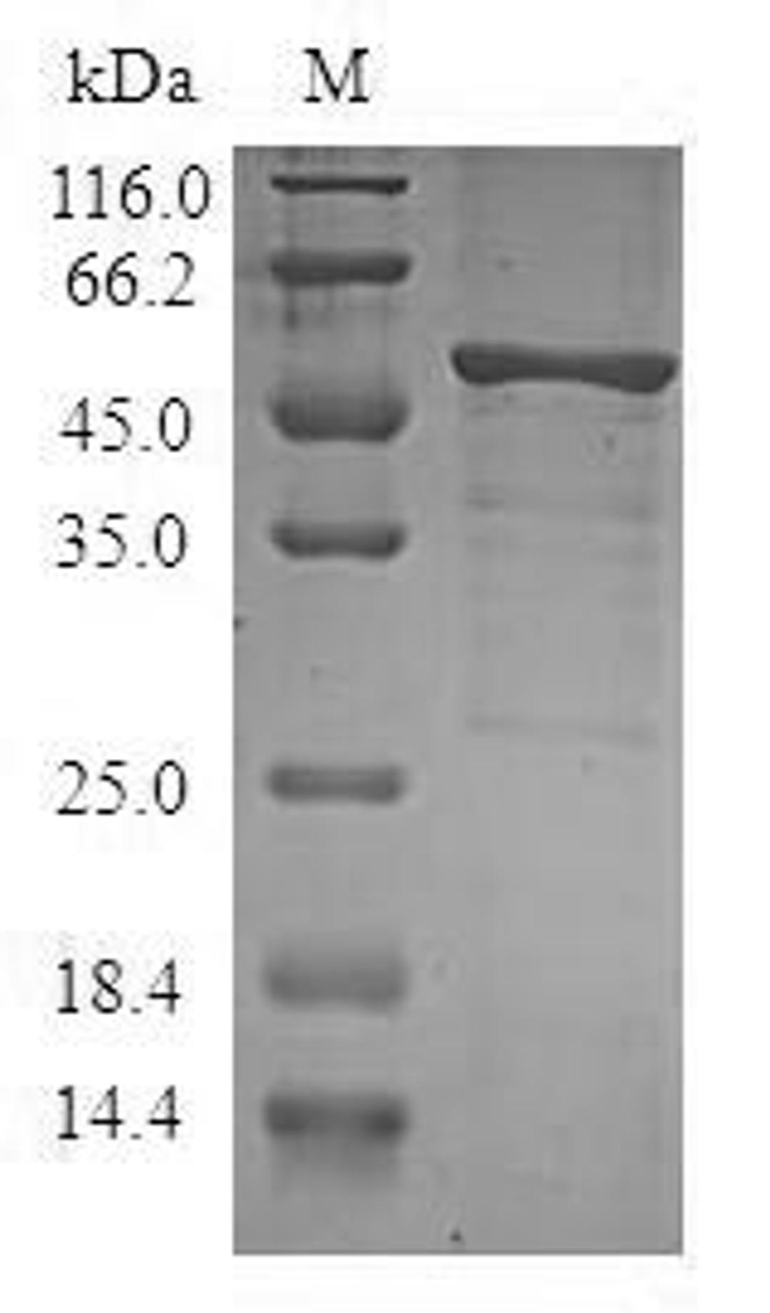 (Tris-Glycine gel) Discontinuous SDS-PAGE (reduced) with 5% enrichment gel and 15% separation gel.