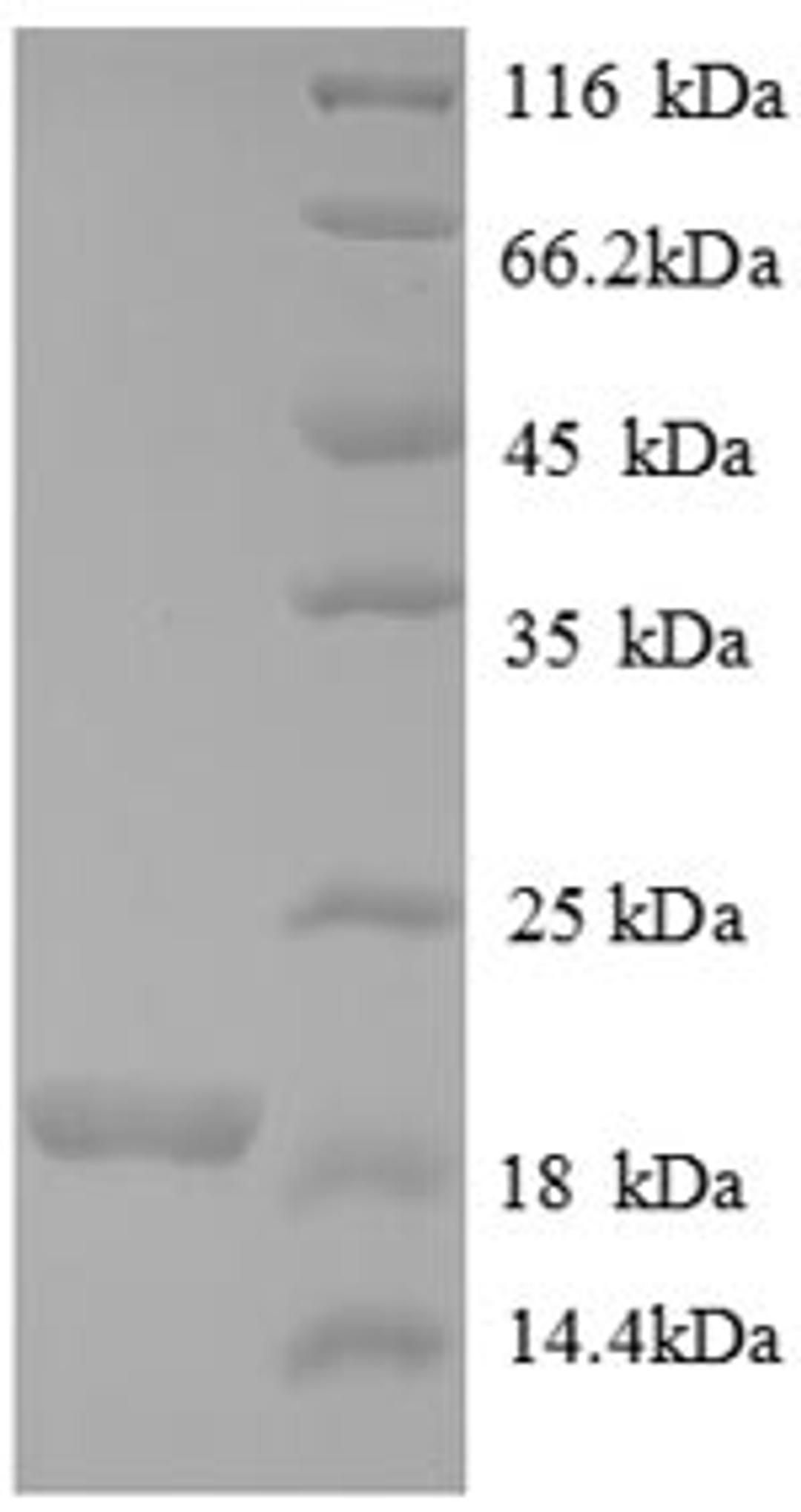 (Tris-Glycine gel) Discontinuous SDS-PAGE (reduced) with 5% enrichment gel and 15% separation gel.