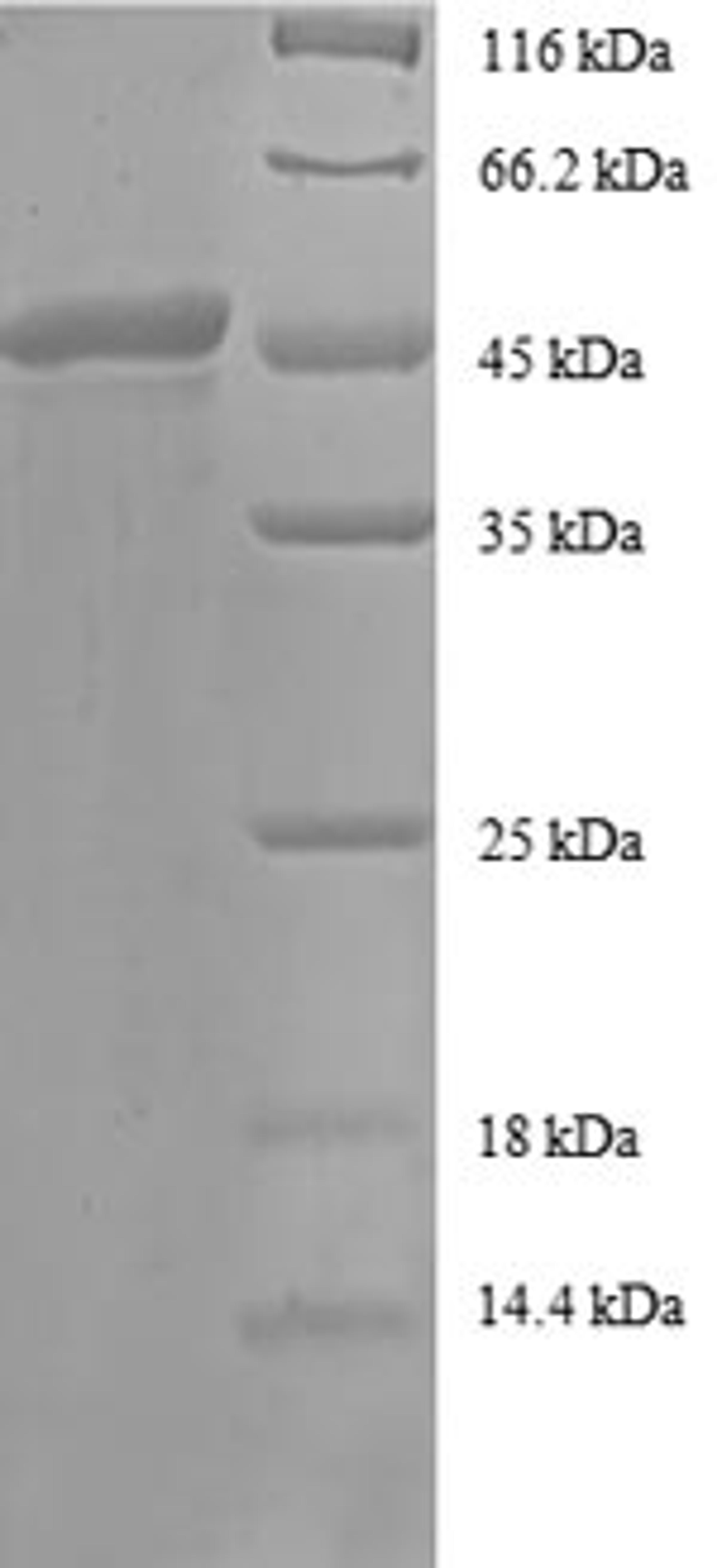 (Tris-Glycine gel) Discontinuous SDS-PAGE (reduced) with 5% enrichment gel and 15% separation gel.