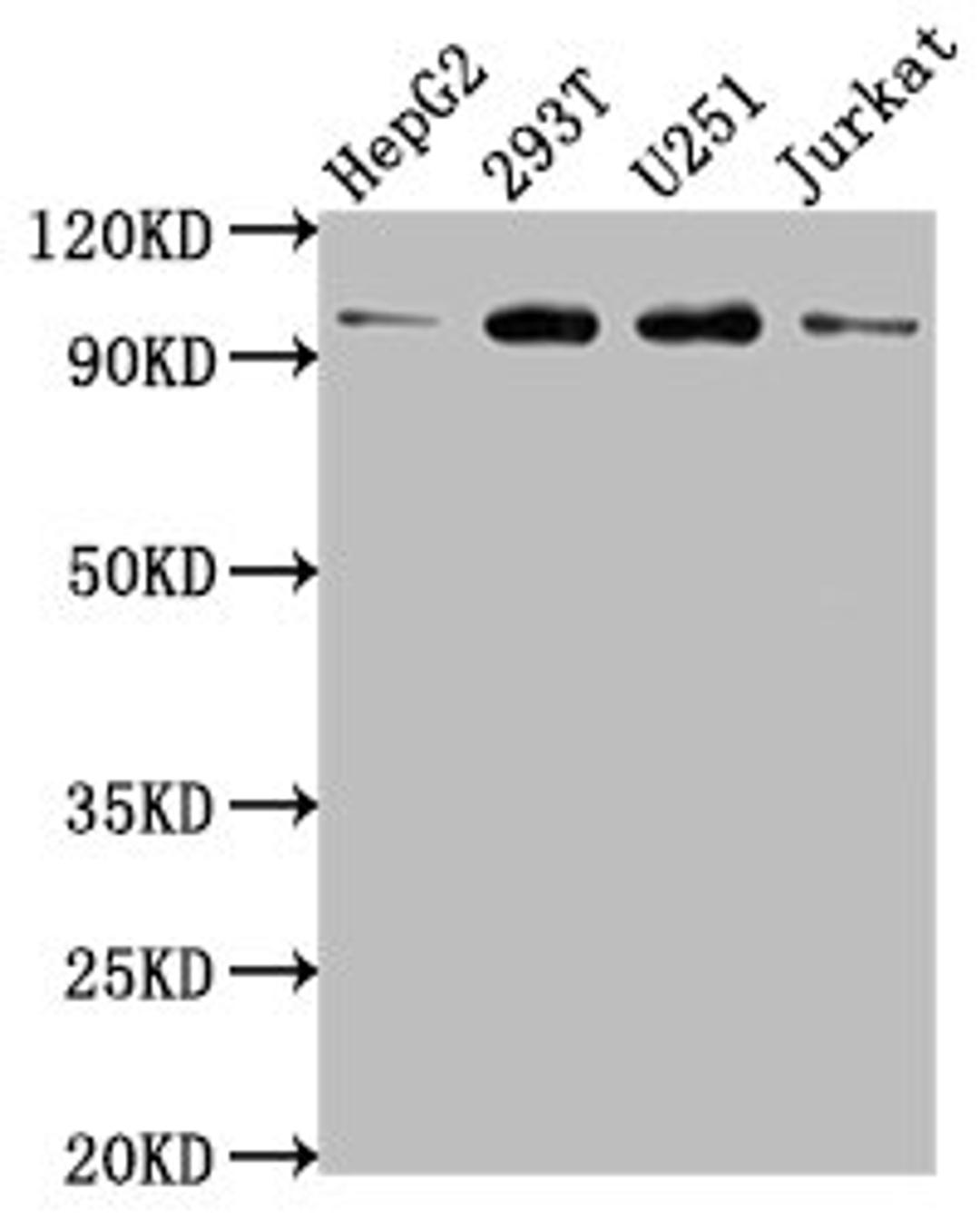 Western Blot. Positive WB detected in: HepG2 whole cell lysate, 293T whole cell lysate, U251 whole cell lysate, Jurkat whole cell lysate. All lanes: KPNB1 antibody at 1:2000. Secondary. Goat polyclonal to rabbit IgG at 1/50000 dilution. Predicted band size: 98, 82 kDa. Observed band size: 98 kDa. 