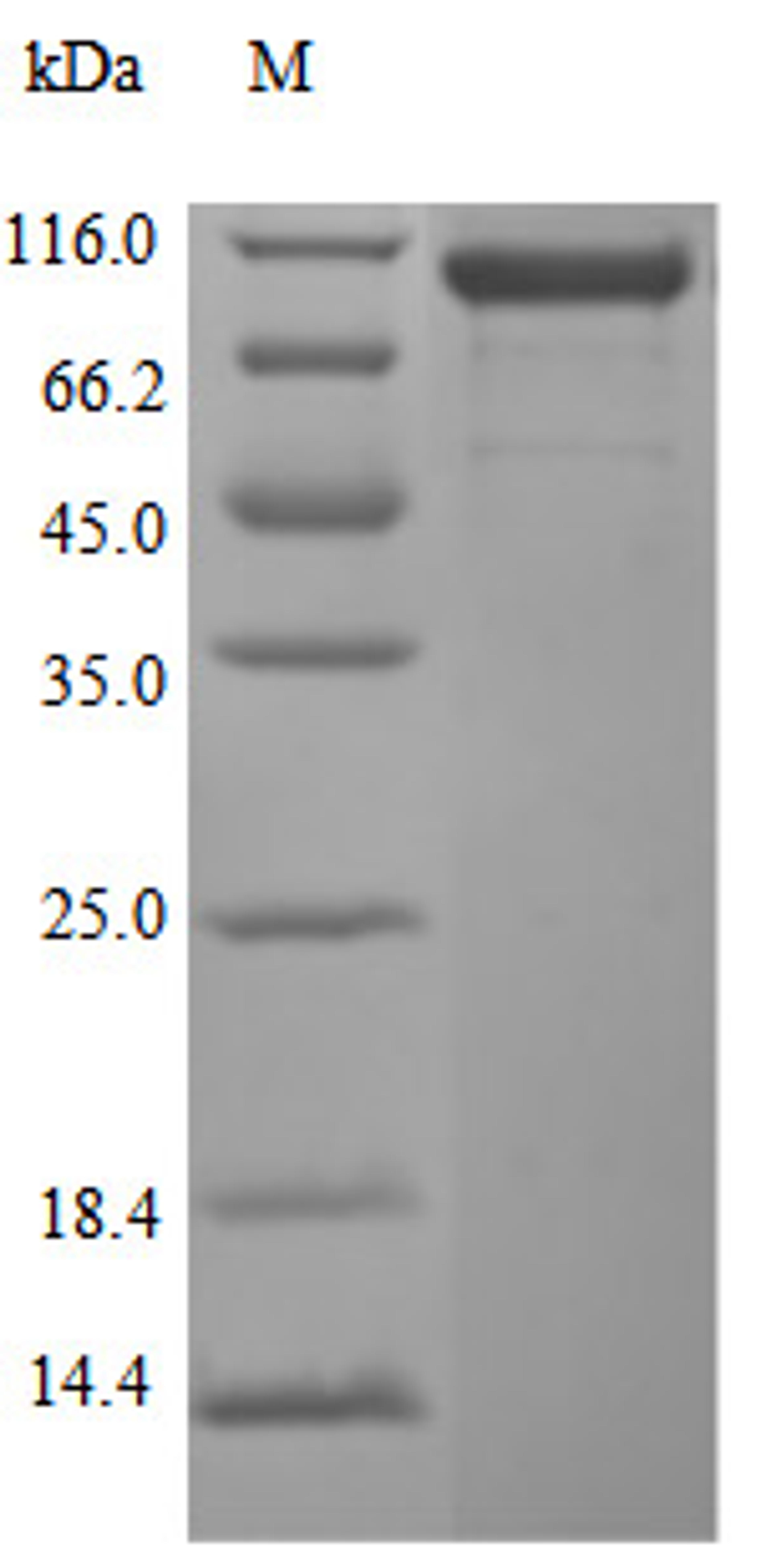 (Tris-Glycine gel) Discontinuous SDS-PAGE (reduced) with 5% enrichment gel and 15% separation gel.