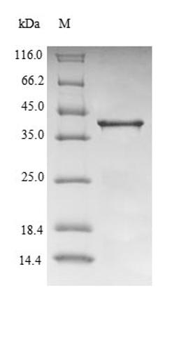 (Tris-Glycine gel) Discontinuous SDS-PAGE (reduced) with 5% enrichment gel and 15% separation gel.