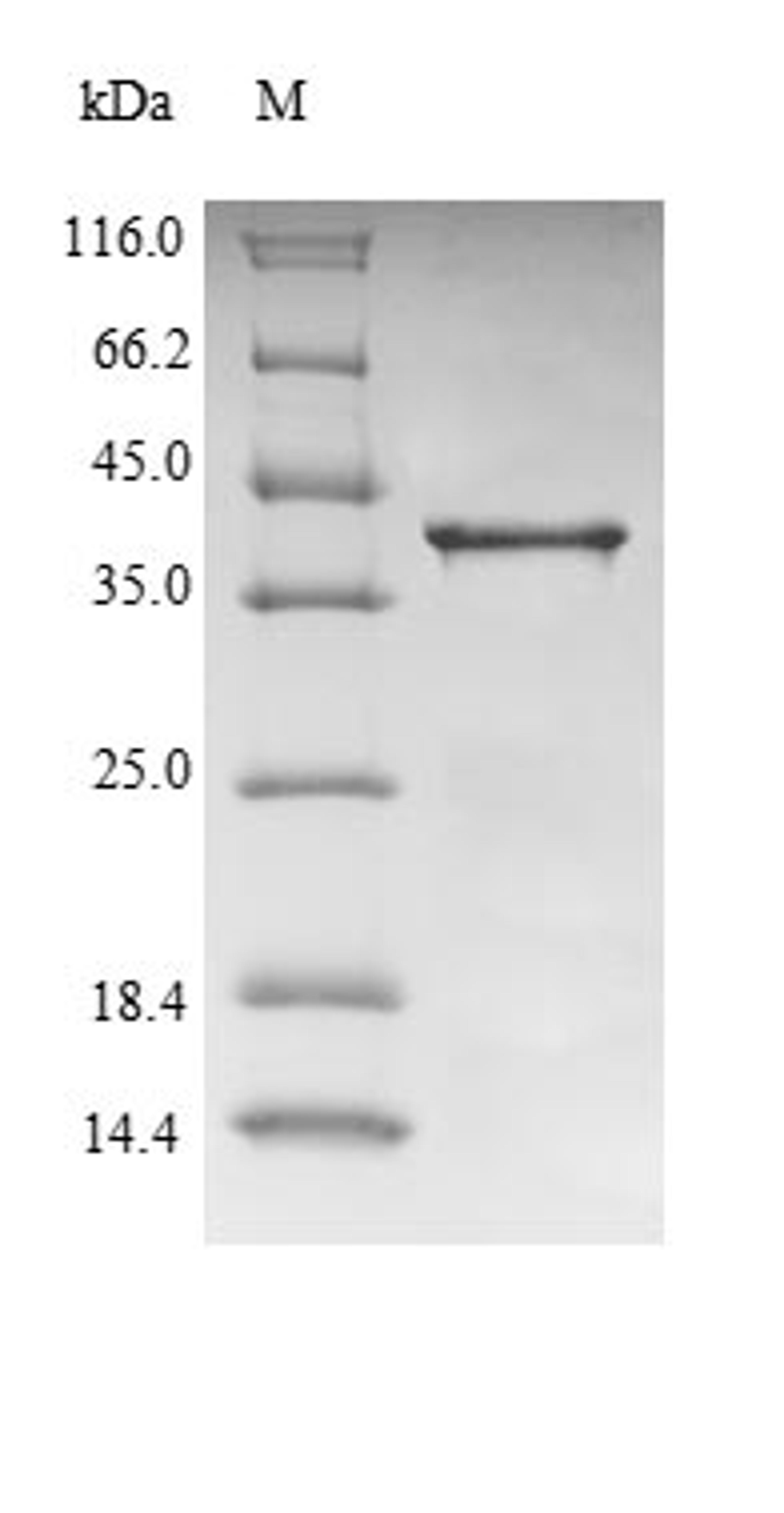 (Tris-Glycine gel) Discontinuous SDS-PAGE (reduced) with 5% enrichment gel and 15% separation gel.
