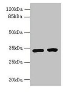 Western blot. All lanes: C3orf49 antibody at 5µg/ml. Lane 1: U251 whole cell lysate. Lane 2: MCF-7 whole cell lysate. Secondary. Goat polyclonal to rabbit IgG at 1/10000 dilution. Predicted band size: 34 kDa. Observed band size: 34 kDa
