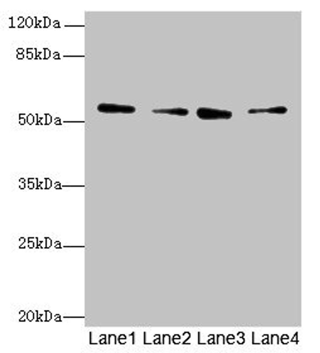 Western blot. All lanes: ERO1B antibody at 3.2µg/ml. Lane 1: MCF-7 whole cell lysate. Lane 2: U251 whole cell lysate. Lane 3: Mouse liver tissue. Lane 4: U87 whole cell lysate. Secondary. Goat polyclonal to rabbit IgG at 1/10000 dilution. Predicted band size: 54, 17 kDa. Observed band size: 54 kDa