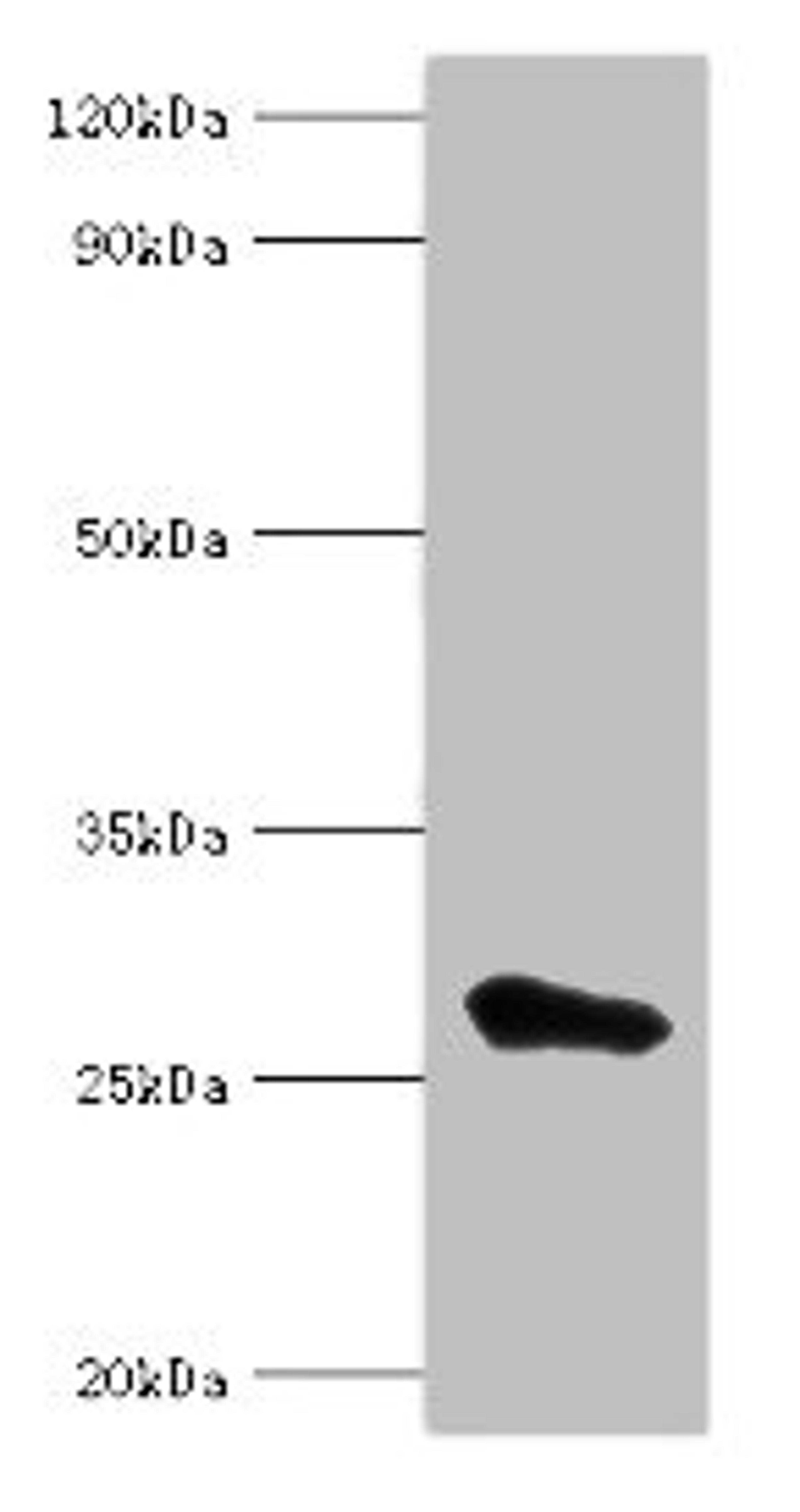 Western blot. All lanes: MED6 antibody at 8ug/ml + Jurkat whole cell lysate. Secondary. Goat polyclonal to rabbit IgG at 1/10000 dilution. Predicted band size: 29, 30, 21 kDa. Observed band size: 29 kDa. 