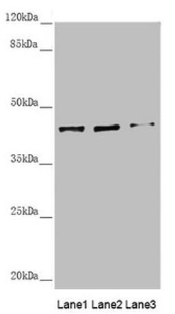 Western blot. All lanes: SCRN2 antibody at 3.61µg/ml. Lane 1: Hela whole cell lysate. Lane 2: A375 whole cell lysate. Lane 3: HepG2 whole cell lysate. Secondary. Goat polyclonal to rabbit IgG at 1/10000 dilution. Predicted band size: 47, 42 kDa. Observed band size: 42 kDa