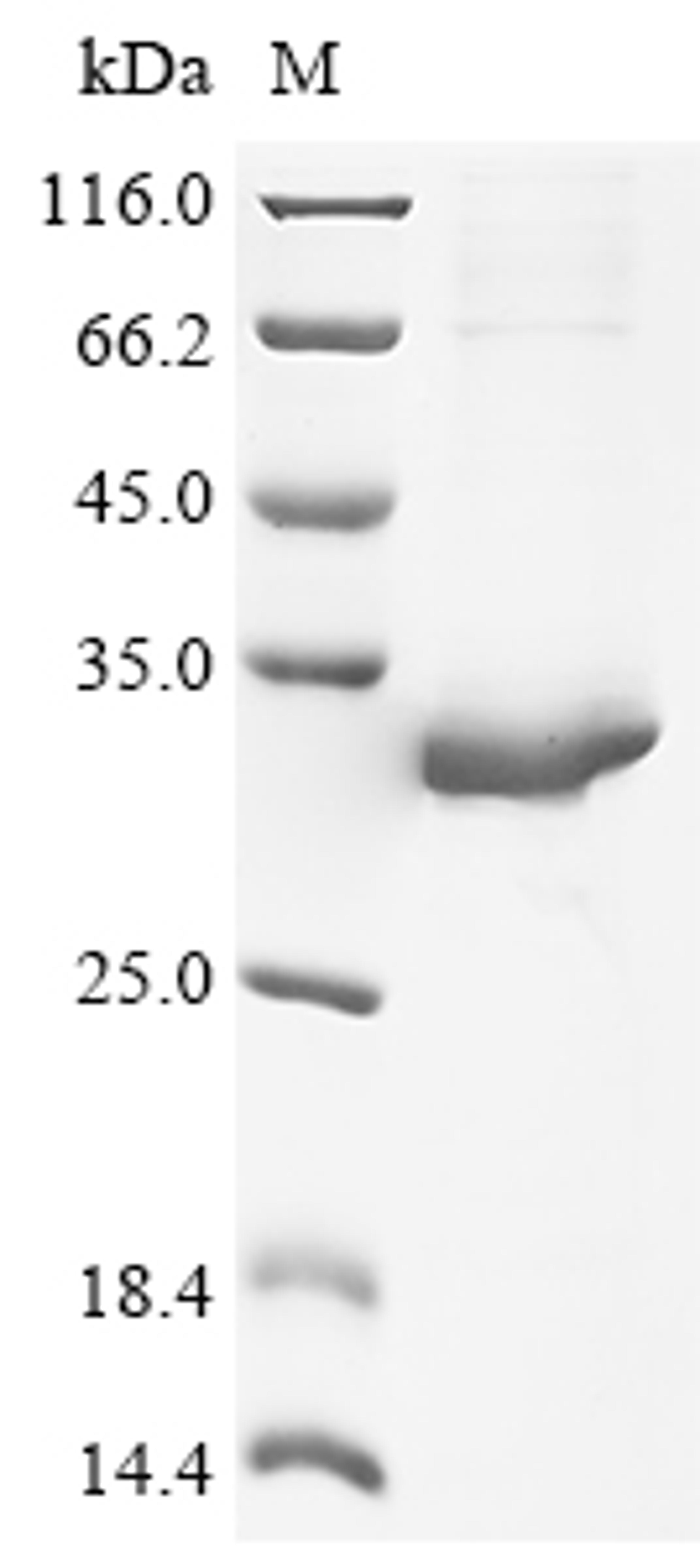 (Tris-Glycine gel) Discontinuous SDS-PAGE (reduced) with 5% enrichment gel and 15% separation gel.
