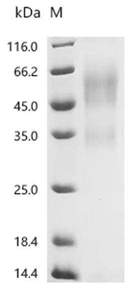 (Tris-Glycine gel) Discontinuous SDS-PAGE (reduced) with 5% enrichment gel and 15% separation gel.