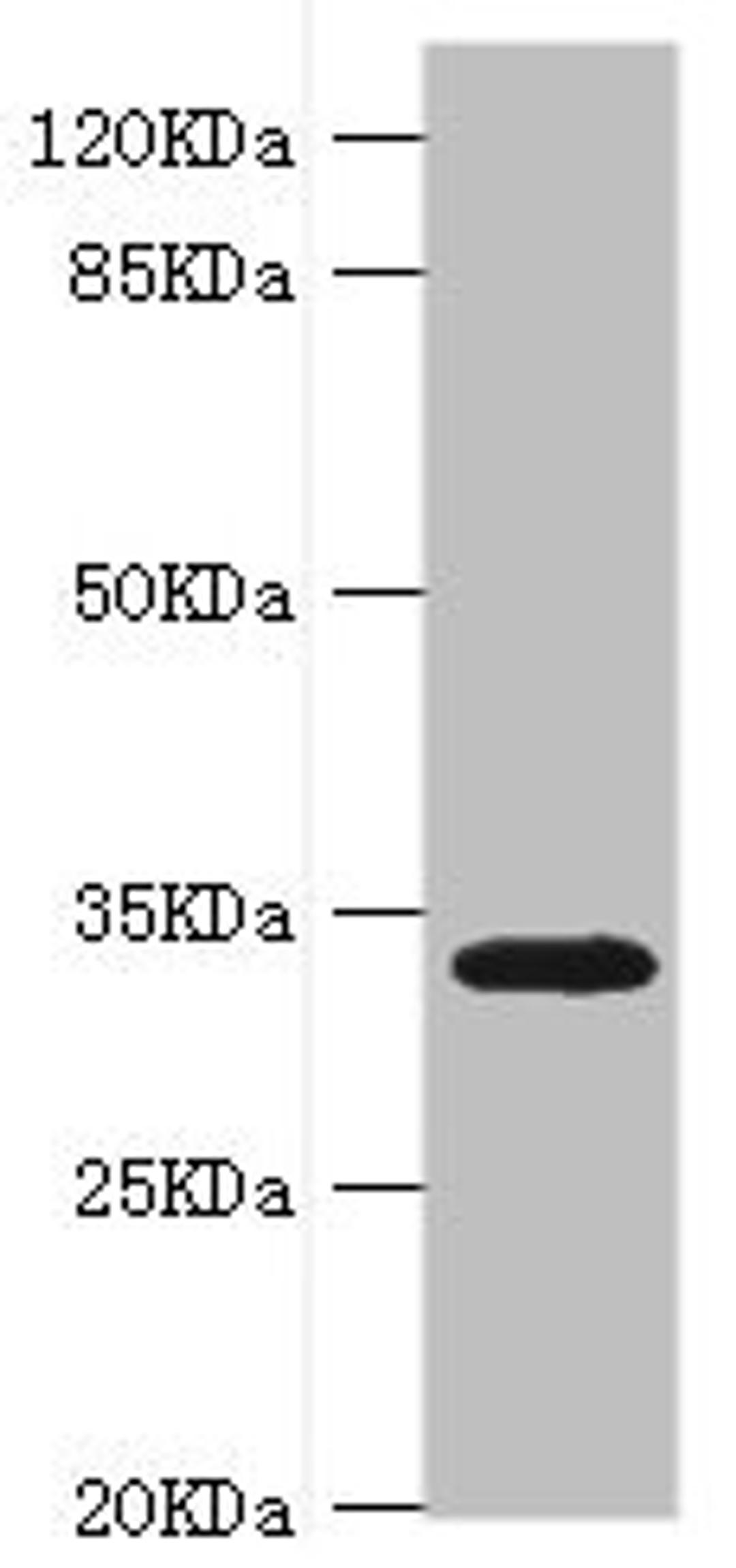 Western blot. All lanes: HMGCL antibody at 0.8ug/ml + Rat liver tissue. Secondary. Goat polyclonal to rabbit IgG at 1/10000 dilution. Predicted band size: 35, 27, 21 kDa. Observed band size: 35 kDa. 