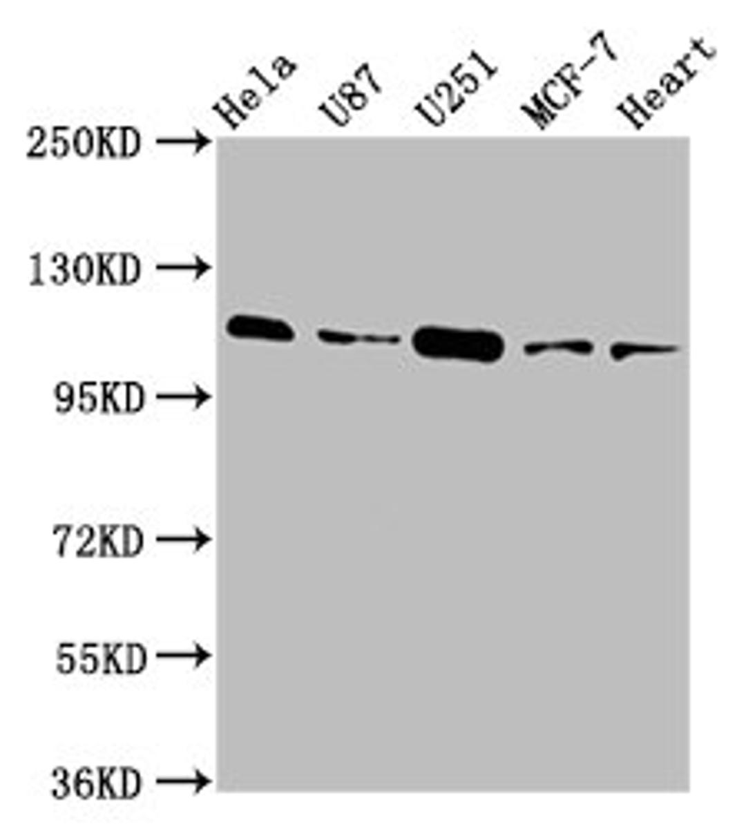 Western Blot. Positive WB detected in: Hela whole cell lysate, U87 whole cell lysate, U251 whole cell lysate, MCF-7 whole cell lysate, Rat heart tissue. All lanes: ANO2 antibody at 3.9µg/ml. Secondary. Goat polyclonal to rabbit IgG at 1/50000 dilution. Predicted band size: 114 kDa. Observed band size: 114 kDa