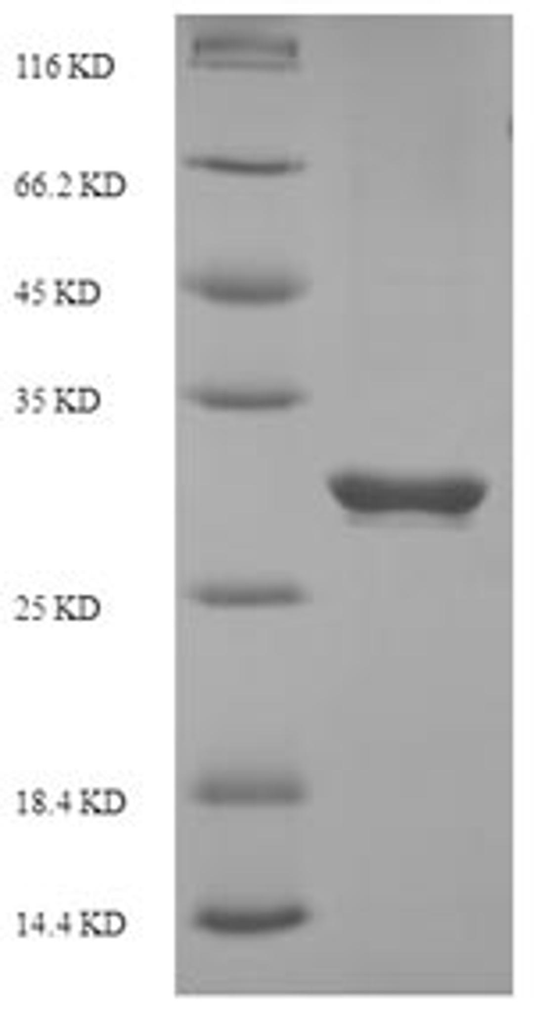 (Tris-Glycine gel) Discontinuous SDS-PAGE (reduced) with 5% enrichment gel and 15% separation gel.