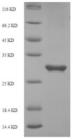 (Tris-Glycine gel) Discontinuous SDS-PAGE (reduced) with 5% enrichment gel and 15% separation gel.