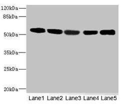 Western blot. All lanes: FRKantibody at 3.13ug/ml. Lane 1: Hela whole cell lysate. Lane 2: 293T whole cell lysate. Lane 3: K562 whole cell lysate. Lane 4: MCF-7 whole cell lysate. Lane 5: HepG2 whole cell lysate. Secondary. Goat polyclonal to rabbit IgG at 1/10000 dilution. Predicted band size: 59, 42 kDa. Observed band size: 59 kDa. 