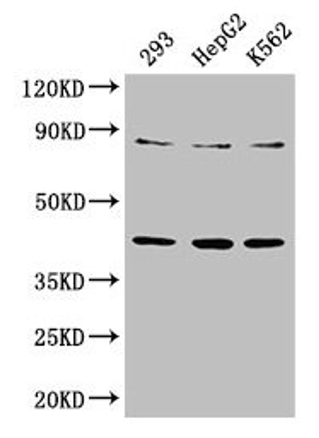Western Blot. Positive WB detected in: 293 whole cell lysate, HepG2 whole cell lysate, K562 whole cell lysate. All lanes: PTPA antibody at 3.3µg/ml. Secondary. Goat polyclonal to rabbit IgG at 1/50000 dilution. Predicted band size: 41, 37, 34, 32 kDa. Observed band size: 41 kDa