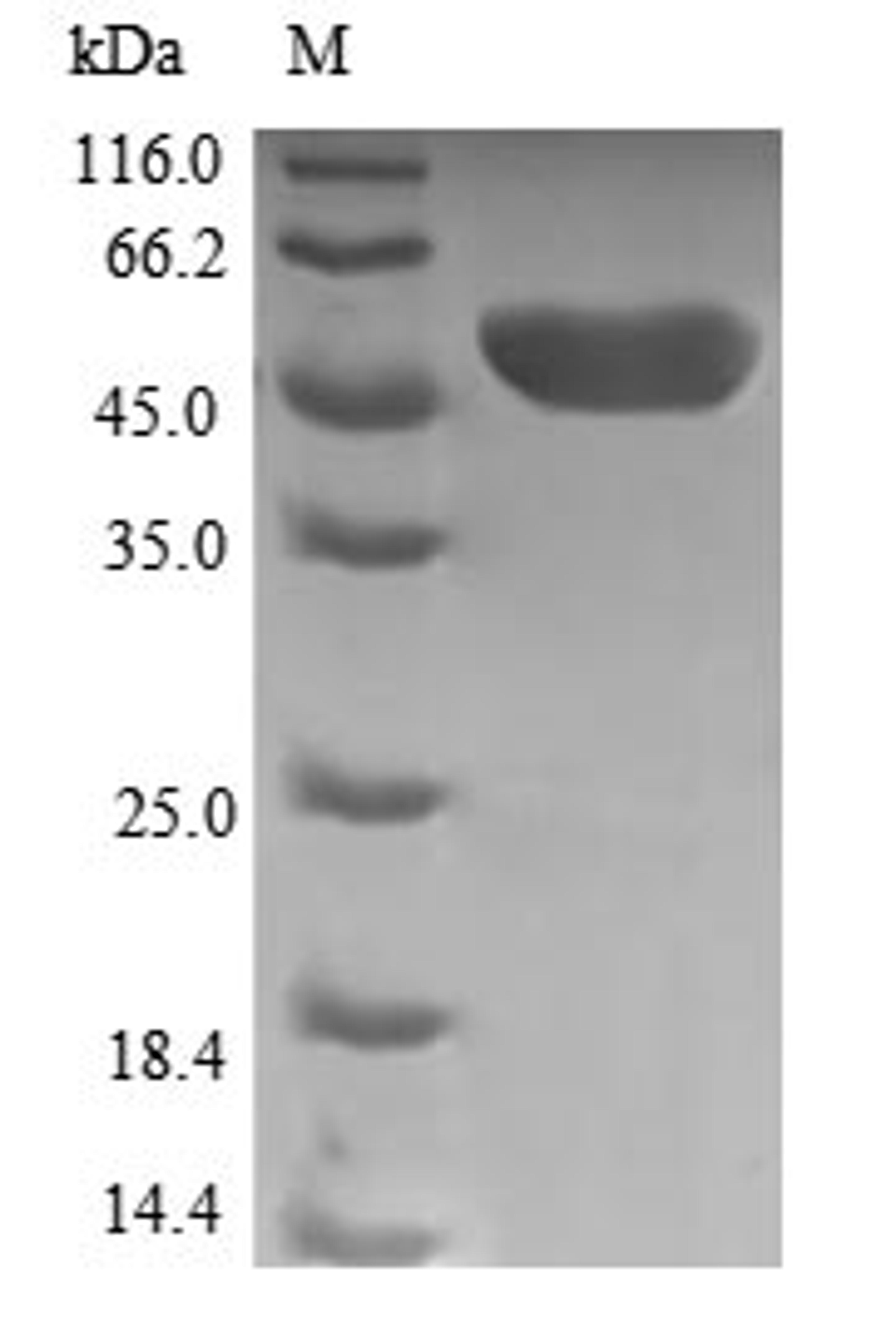 (Tris-Glycine gel) Discontinuous SDS-PAGE (reduced) with 5% enrichment gel and 15% separation gel.