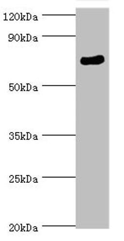Western blot. All lanes: SPAG16 antibody at 6ug/ml + Mouse brain tissue. Secondary. Goat polyclonal to rabbit IgG at 1/10000 dilution. Predicted band size: 71, 51, 30, 21, 40 kDa. Observed band size: 71 kDa. 