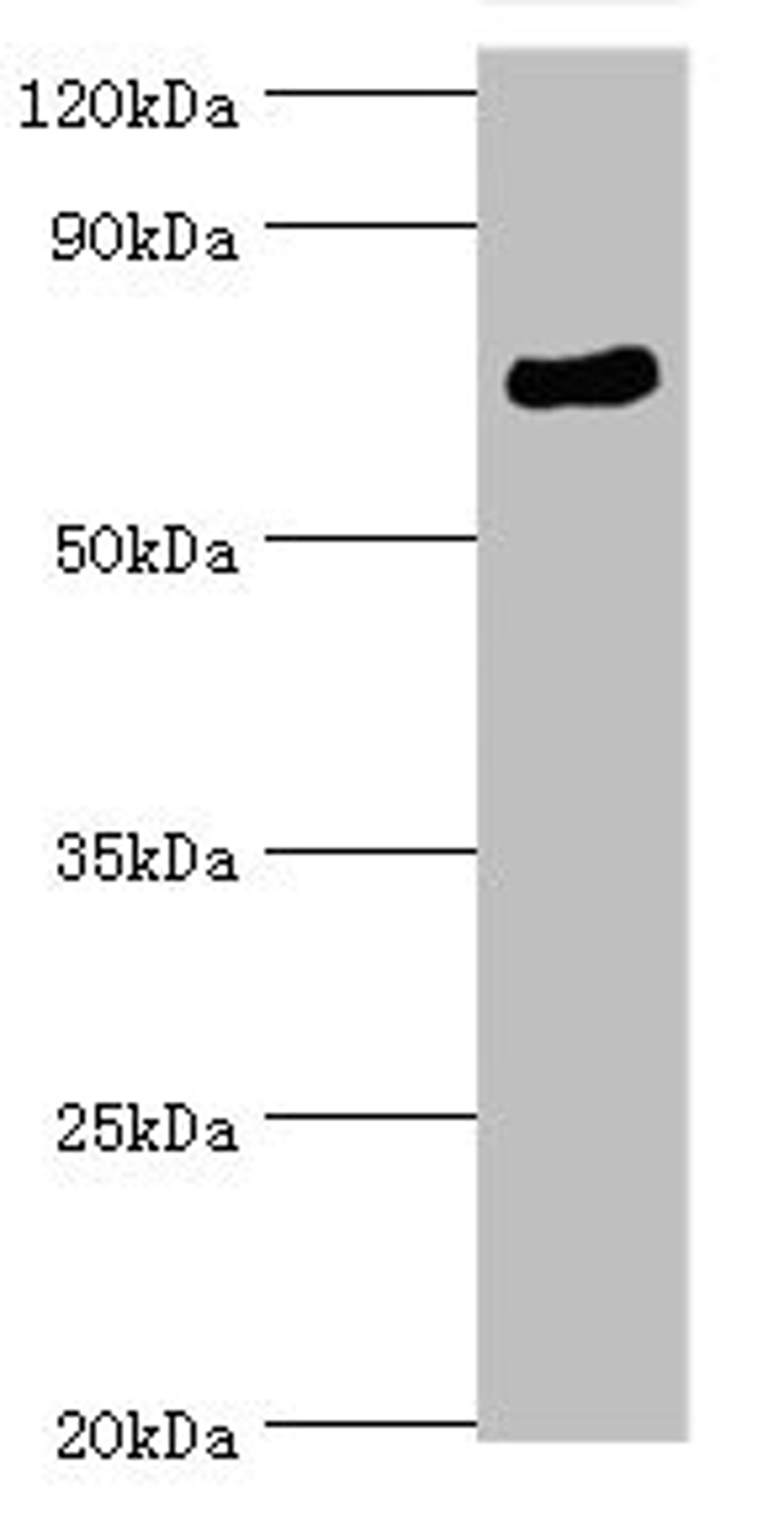 Western blot. All lanes: SPAG16 antibody at 6ug/ml + Mouse brain tissue. Secondary. Goat polyclonal to rabbit IgG at 1/10000 dilution. Predicted band size: 71, 51, 30, 21, 40 kDa. Observed band size: 71 kDa. 