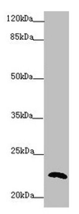 Western blot. All lanes: PPIF antibody at 5.65µg/ml + 293T whole cell lysate. Secondary. Goat polyclonal to rabbit IgG at 1/10000 dilution. Predicted band size: 23, 17 kDa. Observed band size: 23 kDa