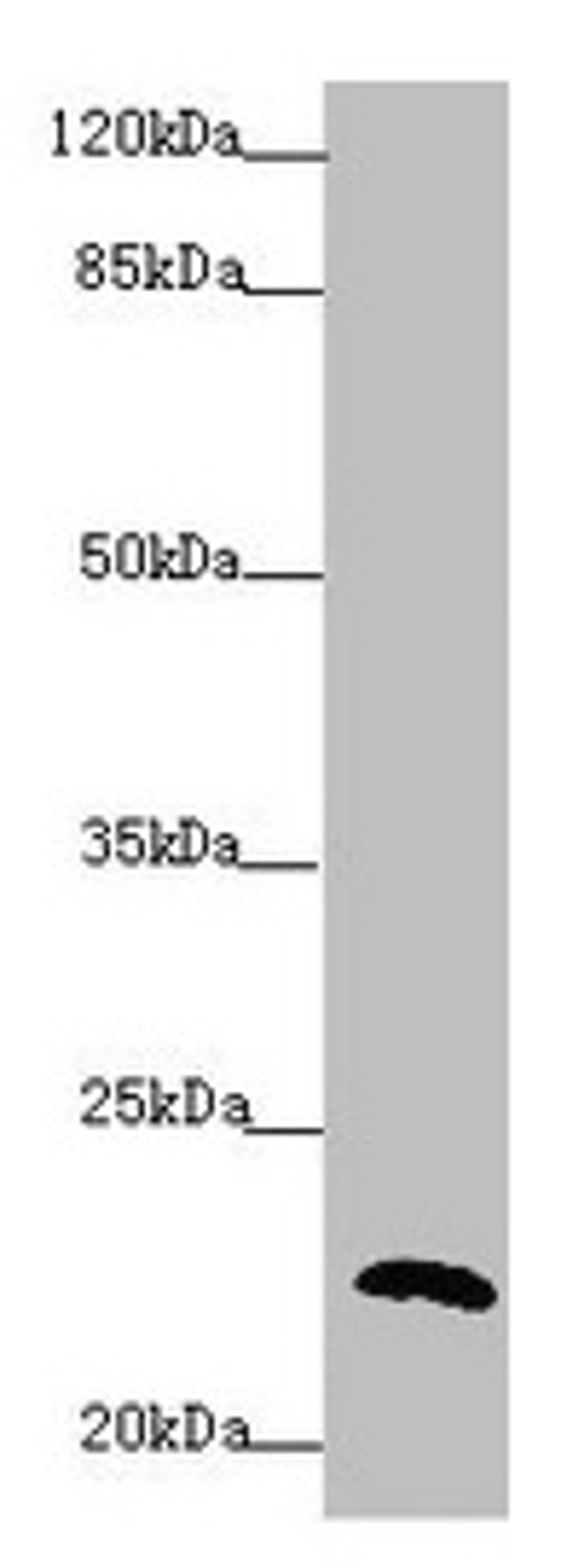 Western blot. All lanes: PPIF antibody at 5.65µg/ml + 293T whole cell lysate. Secondary. Goat polyclonal to rabbit IgG at 1/10000 dilution. Predicted band size: 23, 17 kDa. Observed band size: 23 kDa