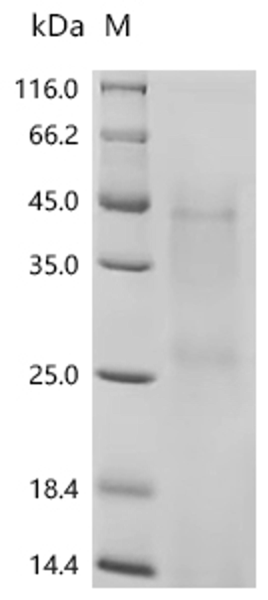 (Tris-Glycine gel) Discontinuous SDS-PAGE (reduced) with 5% enrichment gel and 15% separation gel.