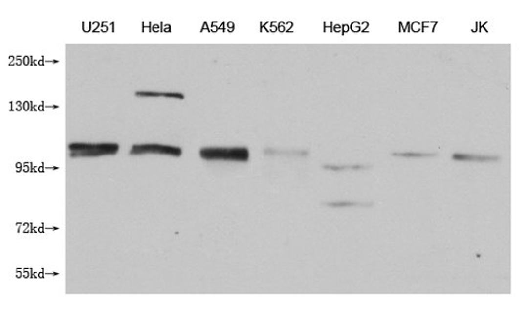 Western Blot. Positive WB detected in: U251 whole cell lysate, Hela whole cell lysate, A549 whole cell lysate, K562 whole cell lysate, HepG2 whole cell lysate, MCF-7 whole cell lysate, Jurkat whole cell lysate. All lanes: MBTPS1 antibody at 1:1000. Secondary. Goat polyclonal to mouse IgG at 1/50000 dilution. Predicted band size: 117 kDa. Observed band size: 117 KDa. Exposure time：5min