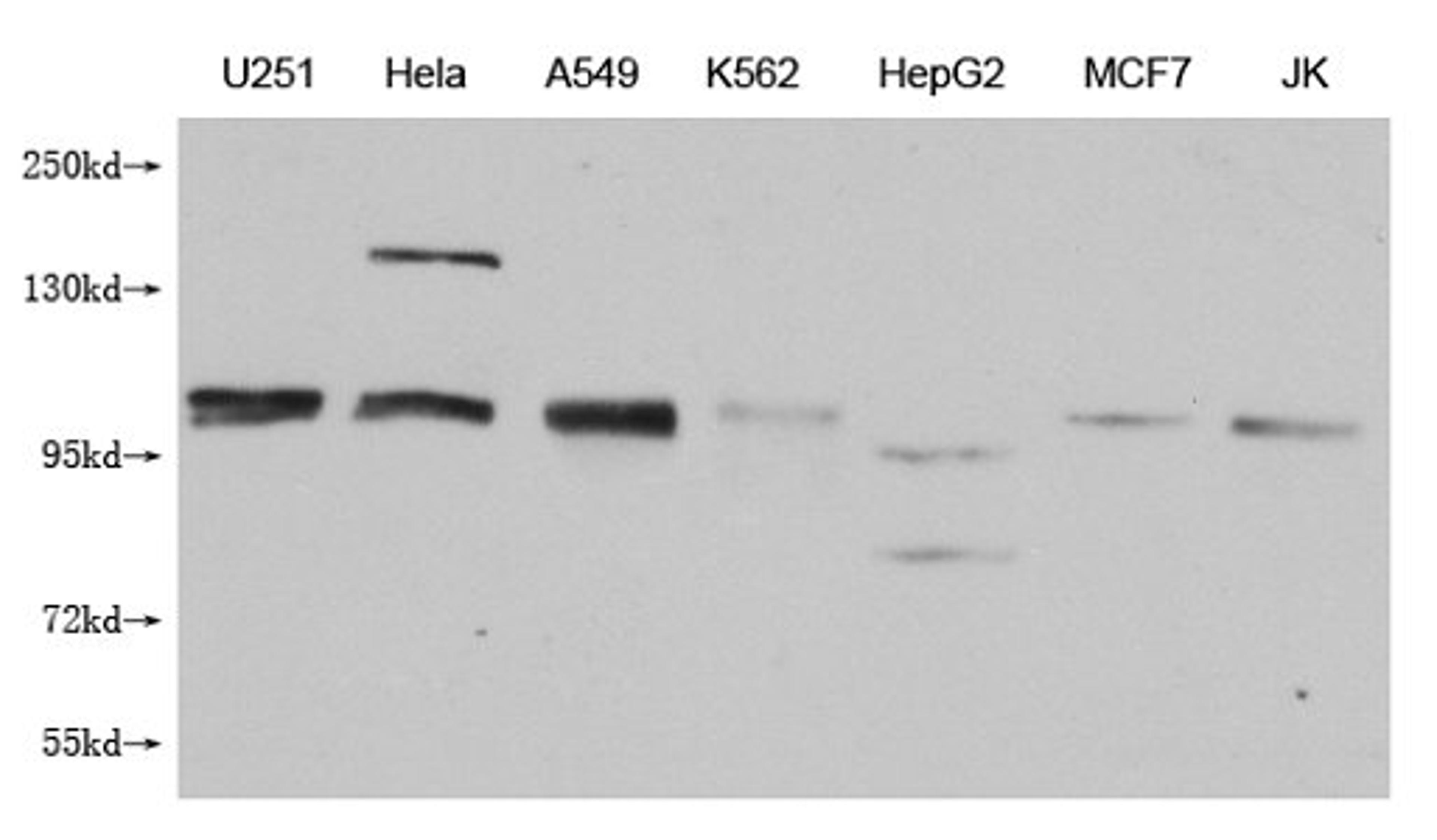 Western Blot. Positive WB detected in: U251 whole cell lysate, Hela whole cell lysate, A549 whole cell lysate, K562 whole cell lysate, HepG2 whole cell lysate, MCF-7 whole cell lysate, Jurkat whole cell lysate. All lanes: MBTPS1 antibody at 1:1000. Secondary. Goat polyclonal to mouse IgG at 1/50000 dilution. Predicted band size: 117 kDa. Observed band size: 117 KDa. Exposure time：5min