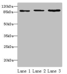 Western blot. All lanes: STAT5B antibody at 16 ug/ml. Lane 1: HepG2 whole cell lysate. Lane 2: K562 whole cell lysate. Lane 3: Hela whole cell lysate. Secondary. Goat polyclonal to rabbit IgG at 1/10000 dilution. Predicted band size: 90 kDa. Observed band size: 90 kDa.