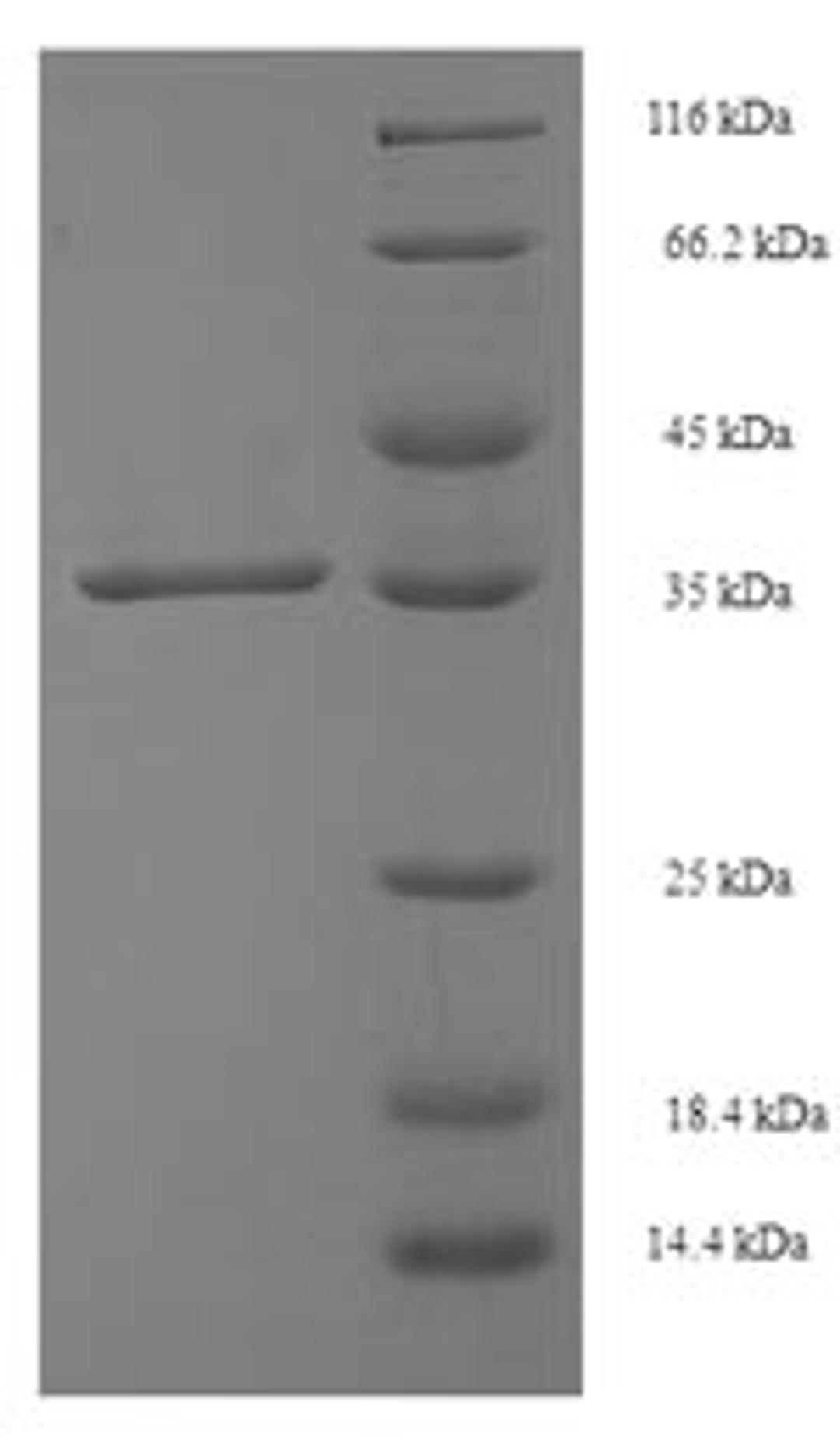 (Tris-Glycine gel) Discontinuous SDS-PAGE (reduced) with 5% enrichment gel and 15% separation gel.