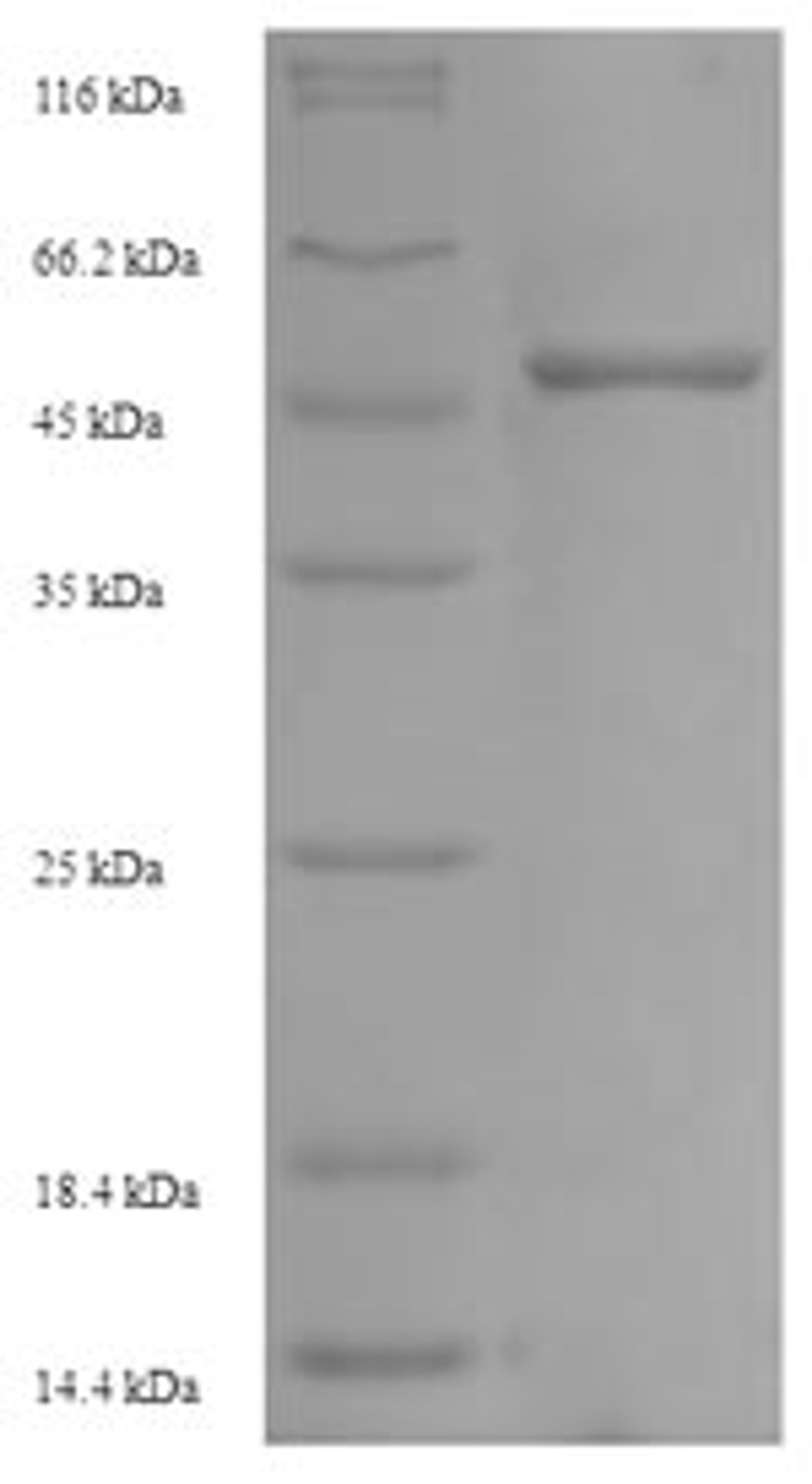 (Tris-Glycine gel) Discontinuous SDS-PAGE (reduced) with 5% enrichment gel and 15% separation gel.