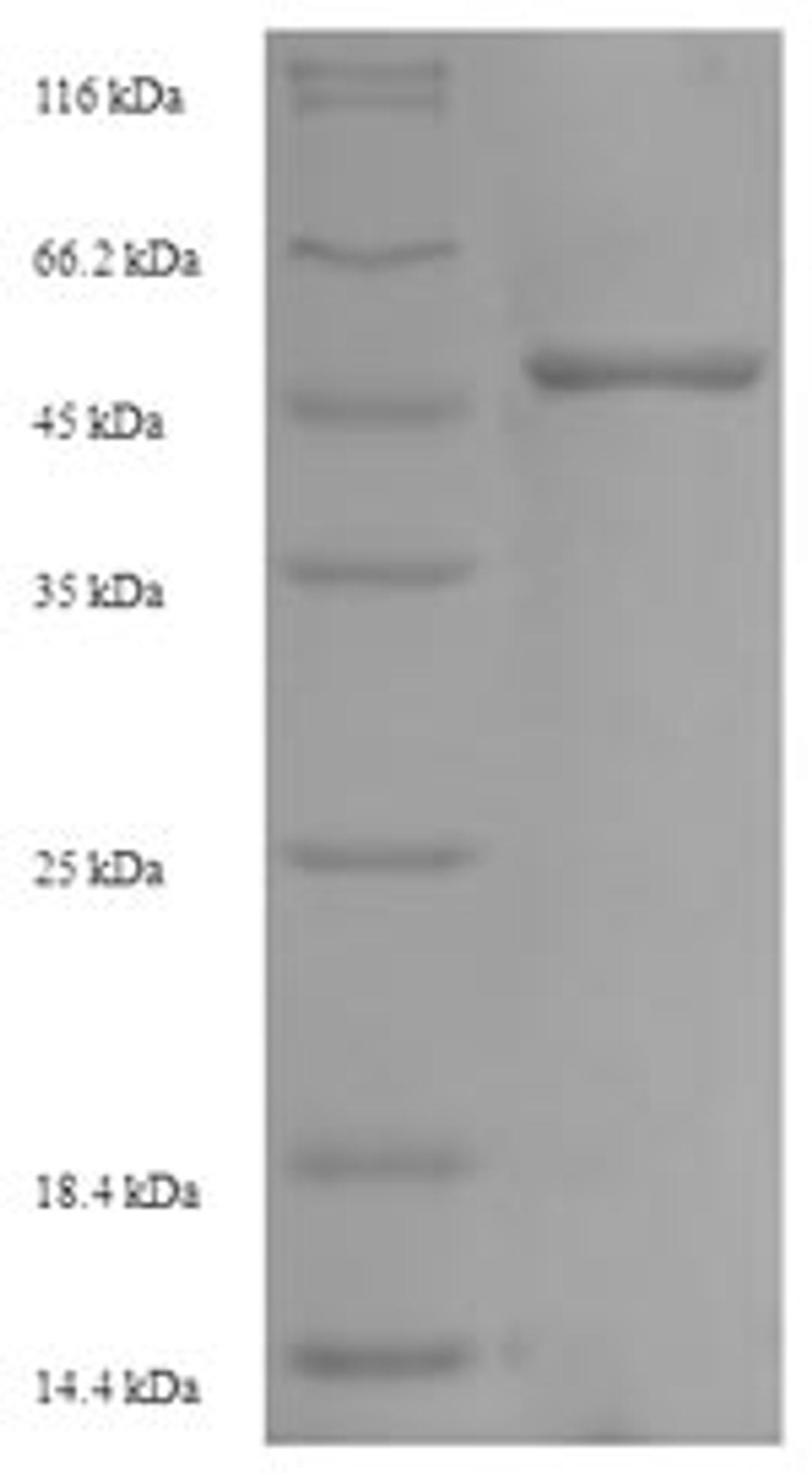 (Tris-Glycine gel) Discontinuous SDS-PAGE (reduced) with 5% enrichment gel and 15% separation gel.