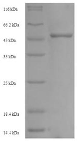 (Tris-Glycine gel) Discontinuous SDS-PAGE (reduced) with 5% enrichment gel and 15% separation gel.