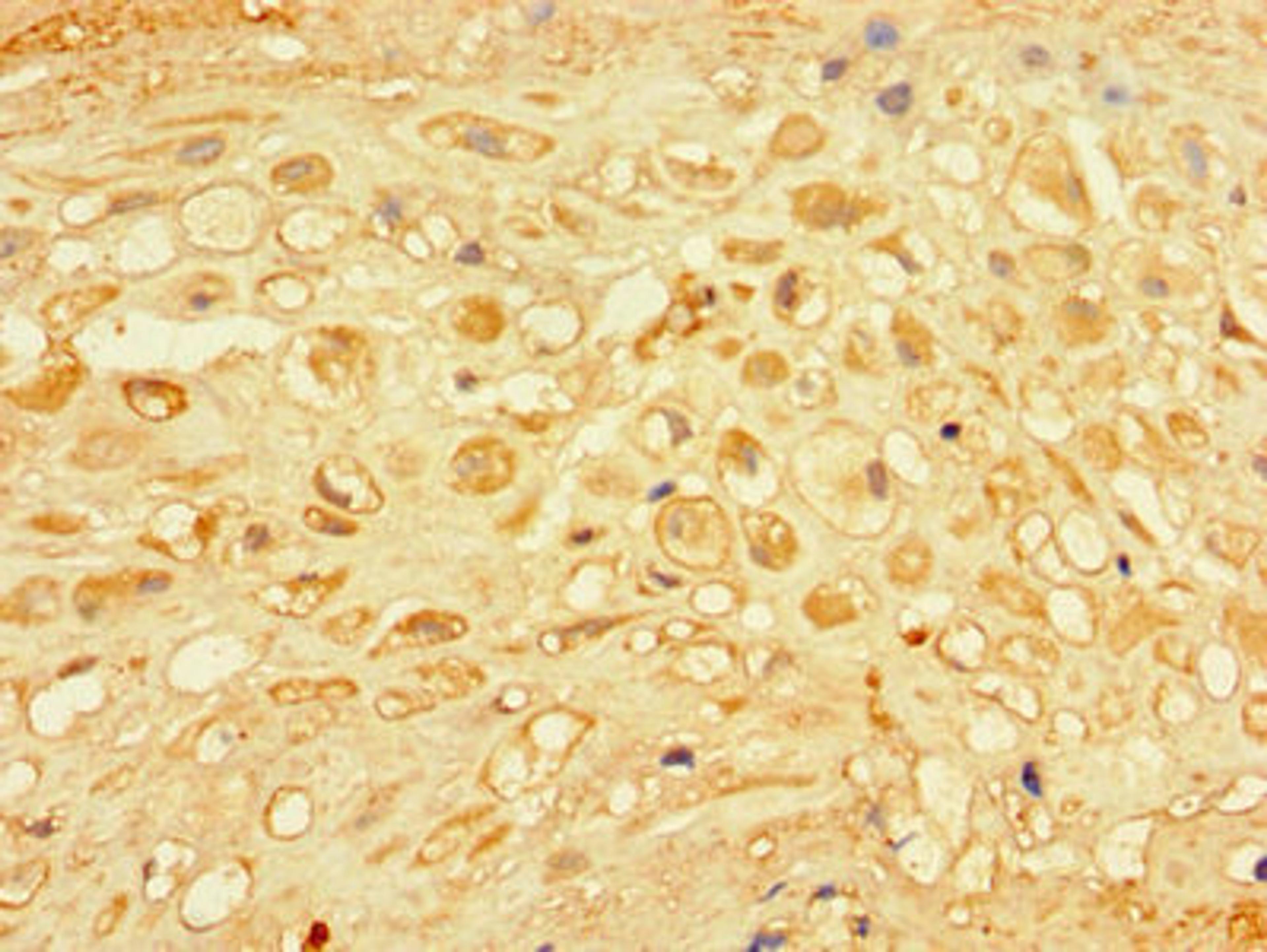 Immunohistochemistry of paraffin-embedded human placenta tissue using CSB-PA005356LA01HU at dilution of 1:100