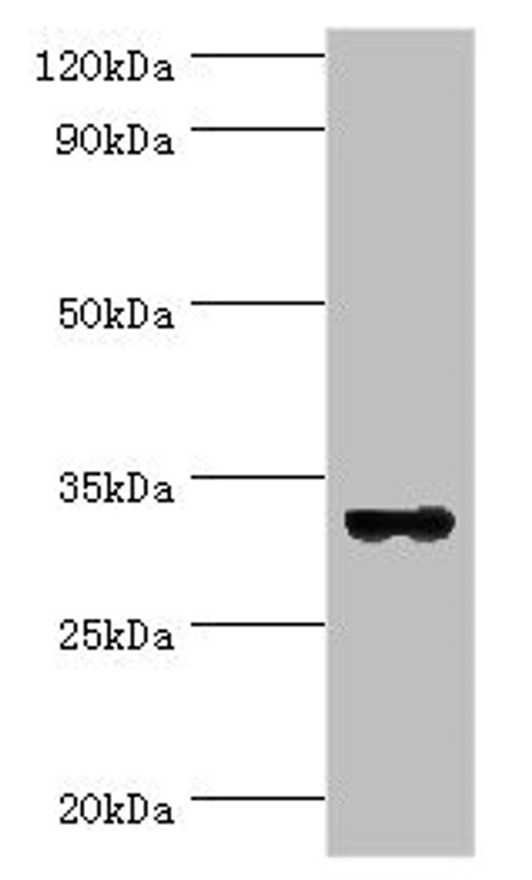 Western blot. All lanes: STX11 antibody at 6ug/ml + Mouse skeletal muscle tissue. Secondary. Goat polyclonal to rabbit IgG at 1/10000 dilution. Predicted band size: 33 kDa. Observed band size: 33 kDa. 